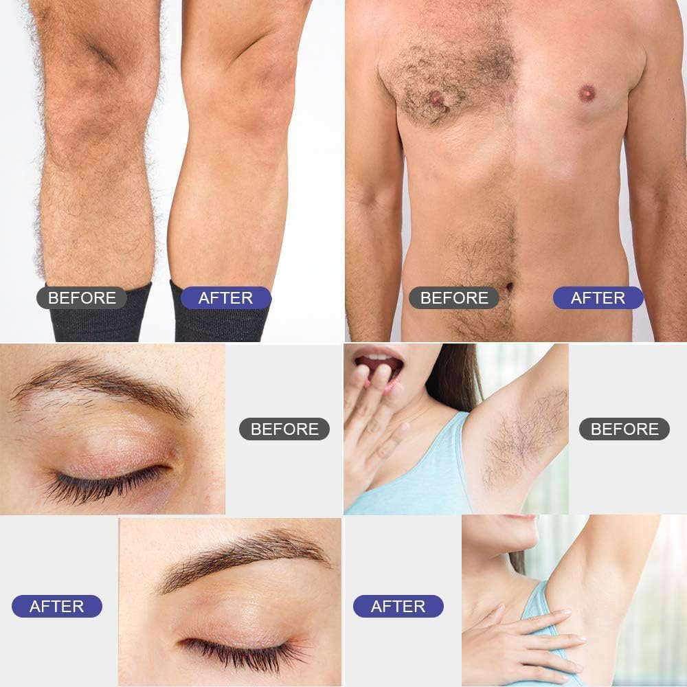 Detalle 1 de Wachswärmer Waxing Set 4 x 100 g für Haarentfernung
