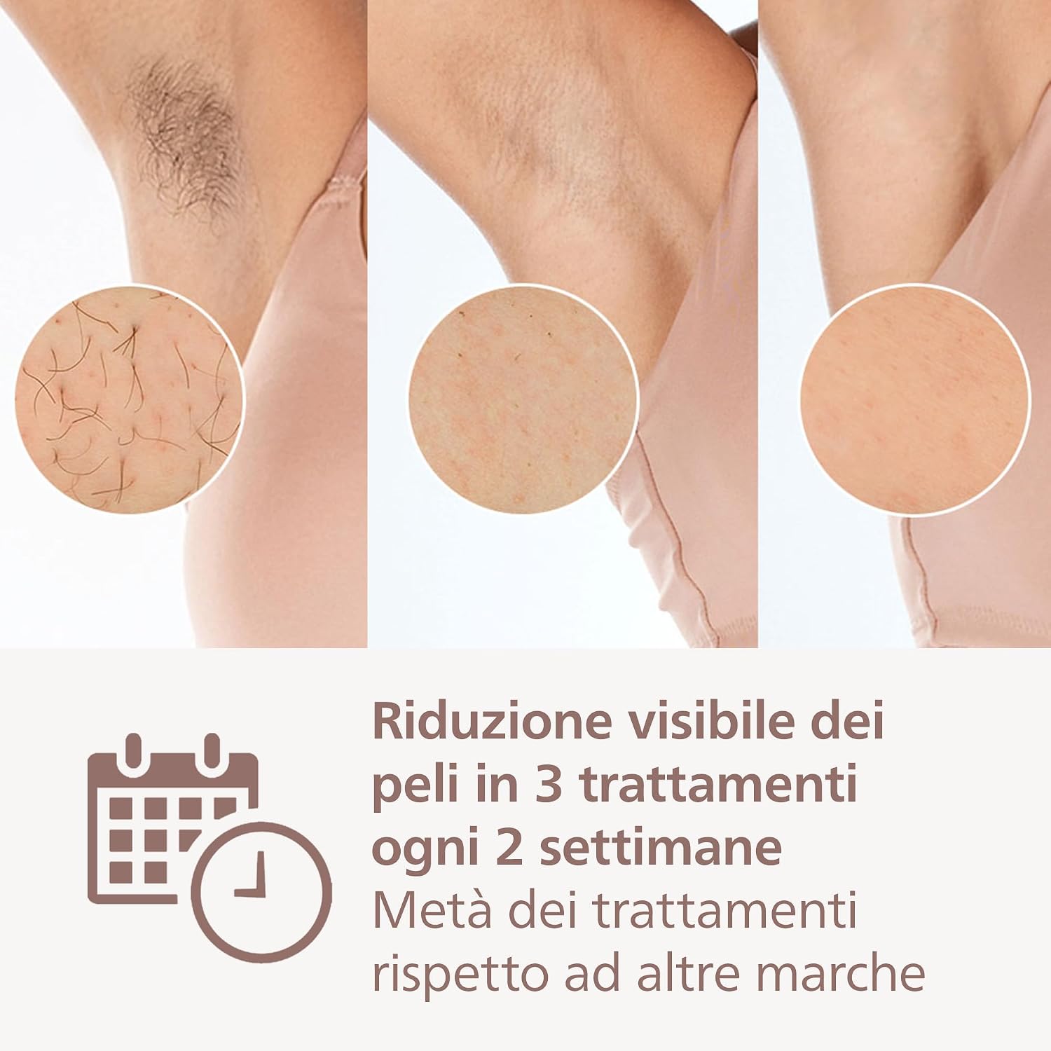 Detalle 2 de Philips Lumea Serie 9900 depilazione IPL 18 mesi