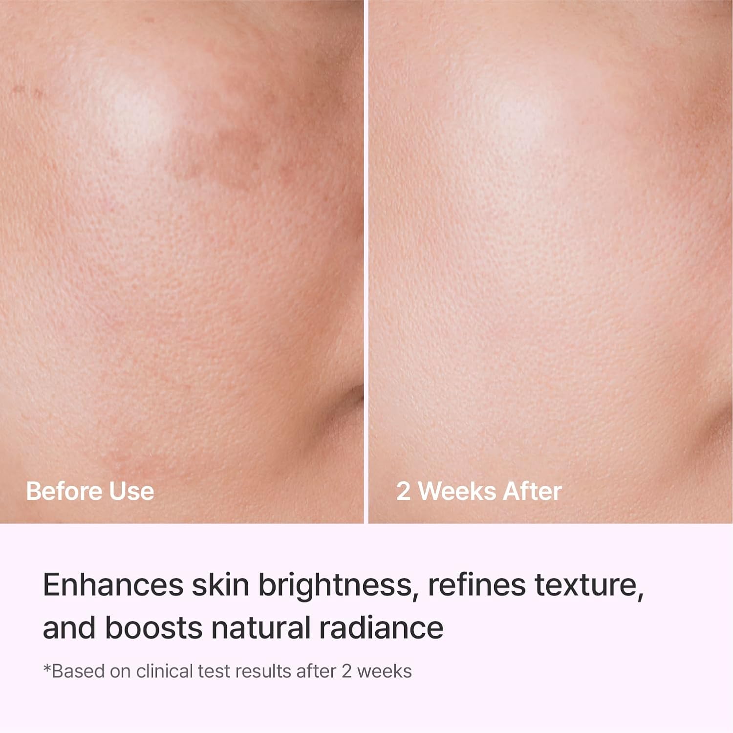 Thumbnail 4 de REJURAN Triple Radiance Ampoule 30ml – DOT™ c-PDRN 0.5% Serum for Tone, Texture & Glow
