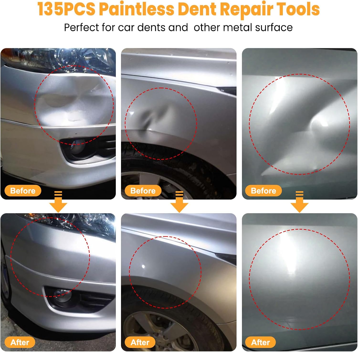 Thumbnail 3 de Sigoobal Car Dents Removal Kit, 135 Pieces ⚙