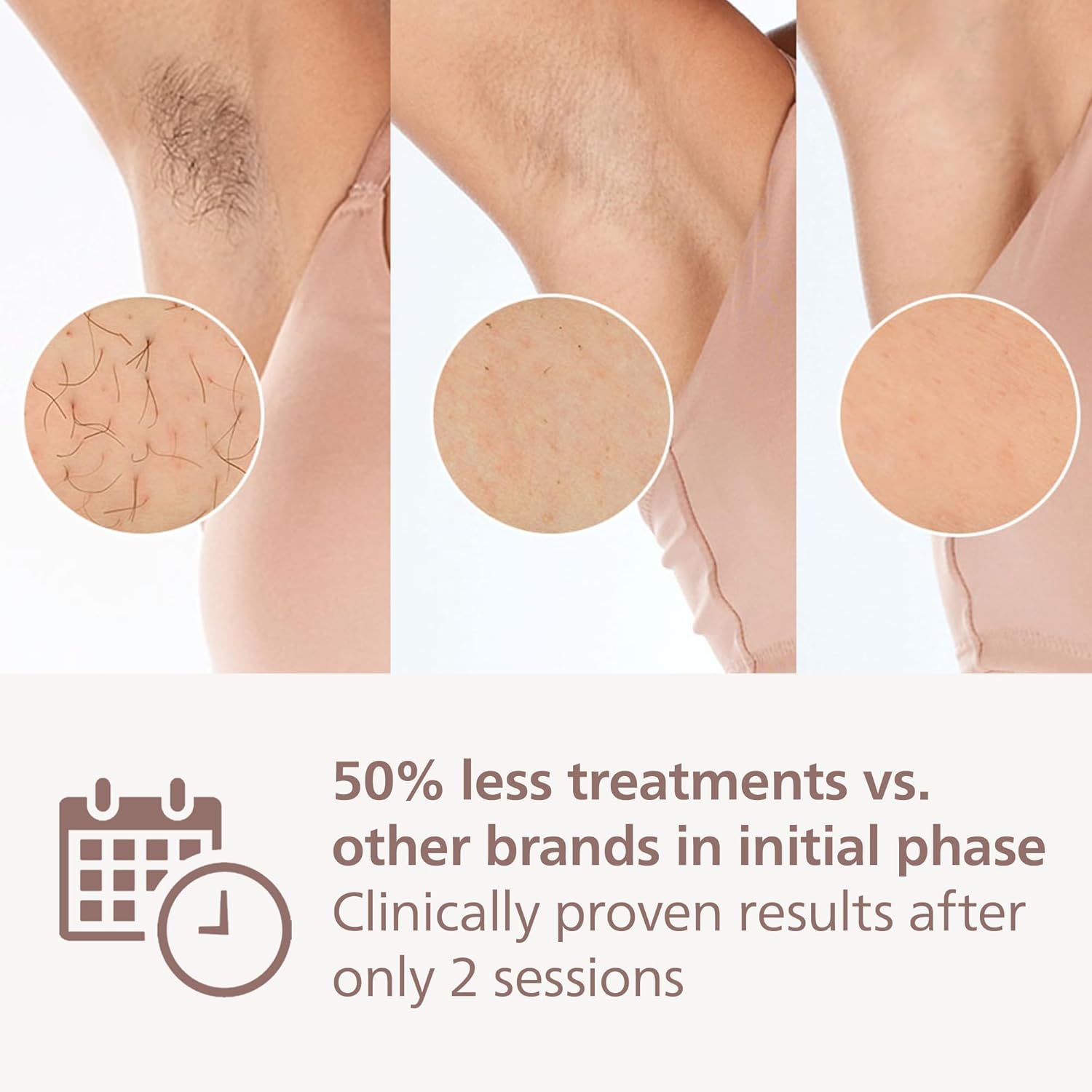 Thumbnail 3 de Philips Lumea 7000 Series BRI923/00 IPL hair removal device with satin compact pen trimmer and 3 attachments