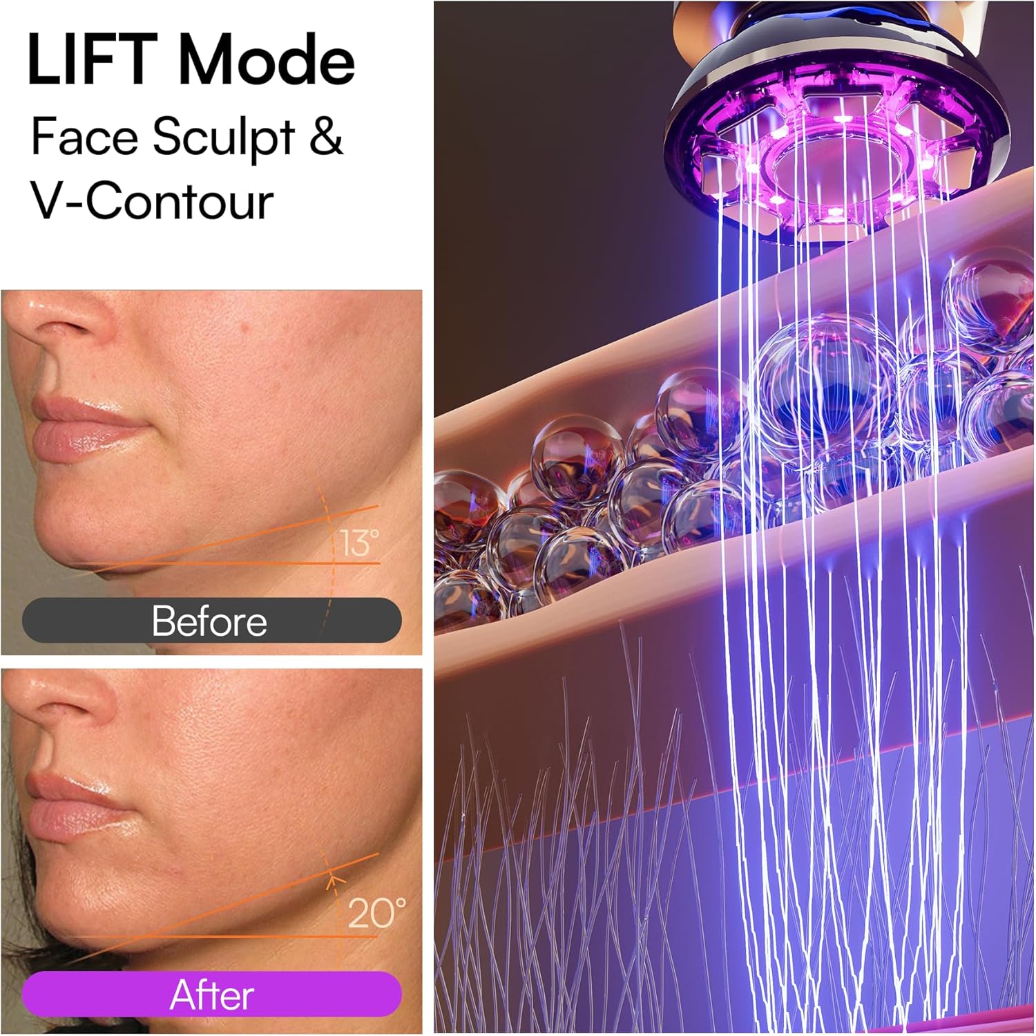 Thumbnail 4 de INIA Flare 3-in-1 Microcurrent Facial Device with Red Light Therapy