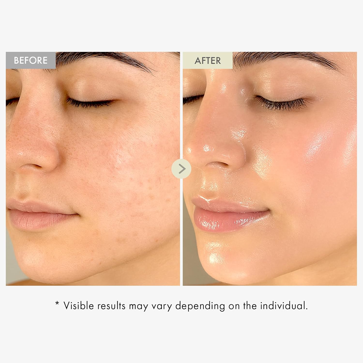 Detalle de TOSOWOONG Siero Real Collagen Viso – siero idratante con collagene idrolizzato e acido ialuronico (33 ml)