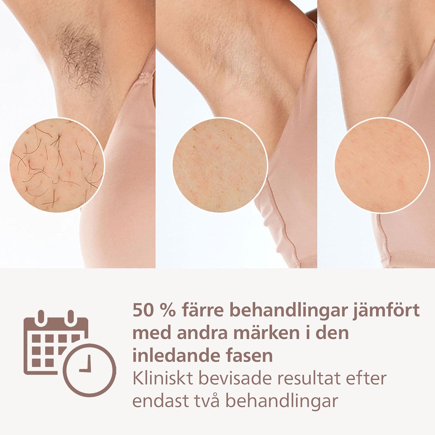Detalle de Philips Lumea 8000 Series BRI944/00, nätdriven IPL-enhet med SenseIQ