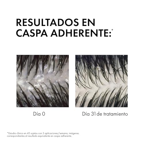 Detalle 2 de Vichy Dercos Anti-Dandruff Shampoo 390ml