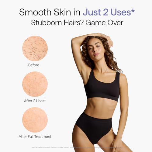 Detalle 1 de Ulike Air 10 UI20 DB IPL Hair Removal Device with Dual Lights and Ice Cooling