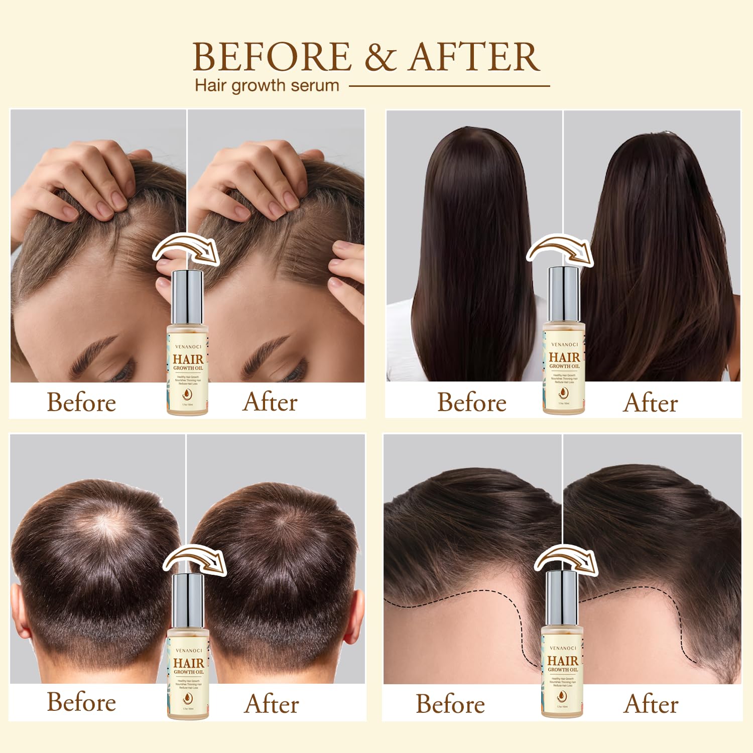 Thumbnail 1 de Hair Growth Oil with Rosemary 3-5 drops