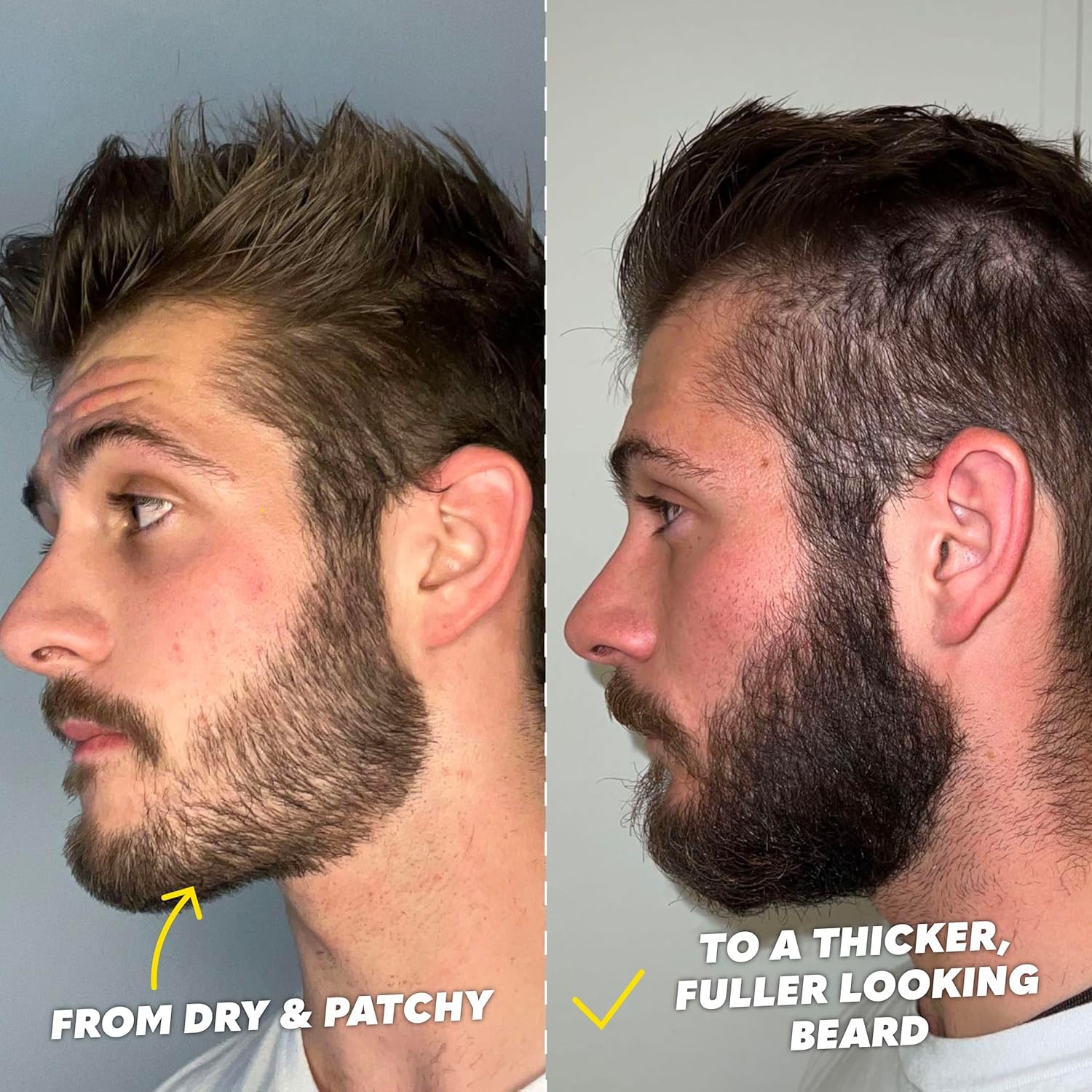 Thumbnail 4 de The Beard Club Titanium Beard Growth Kit ⚙