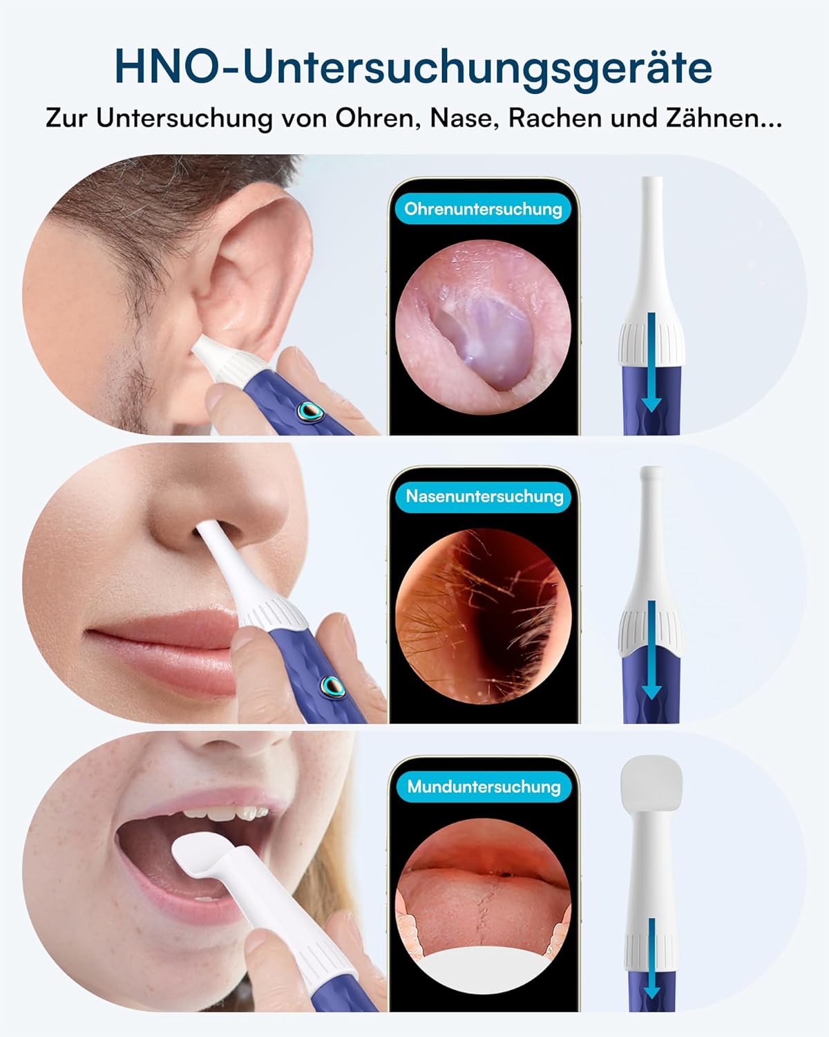 Thumbnail 4 de BEBIRD 1920P Ohrenschmalz Entferner