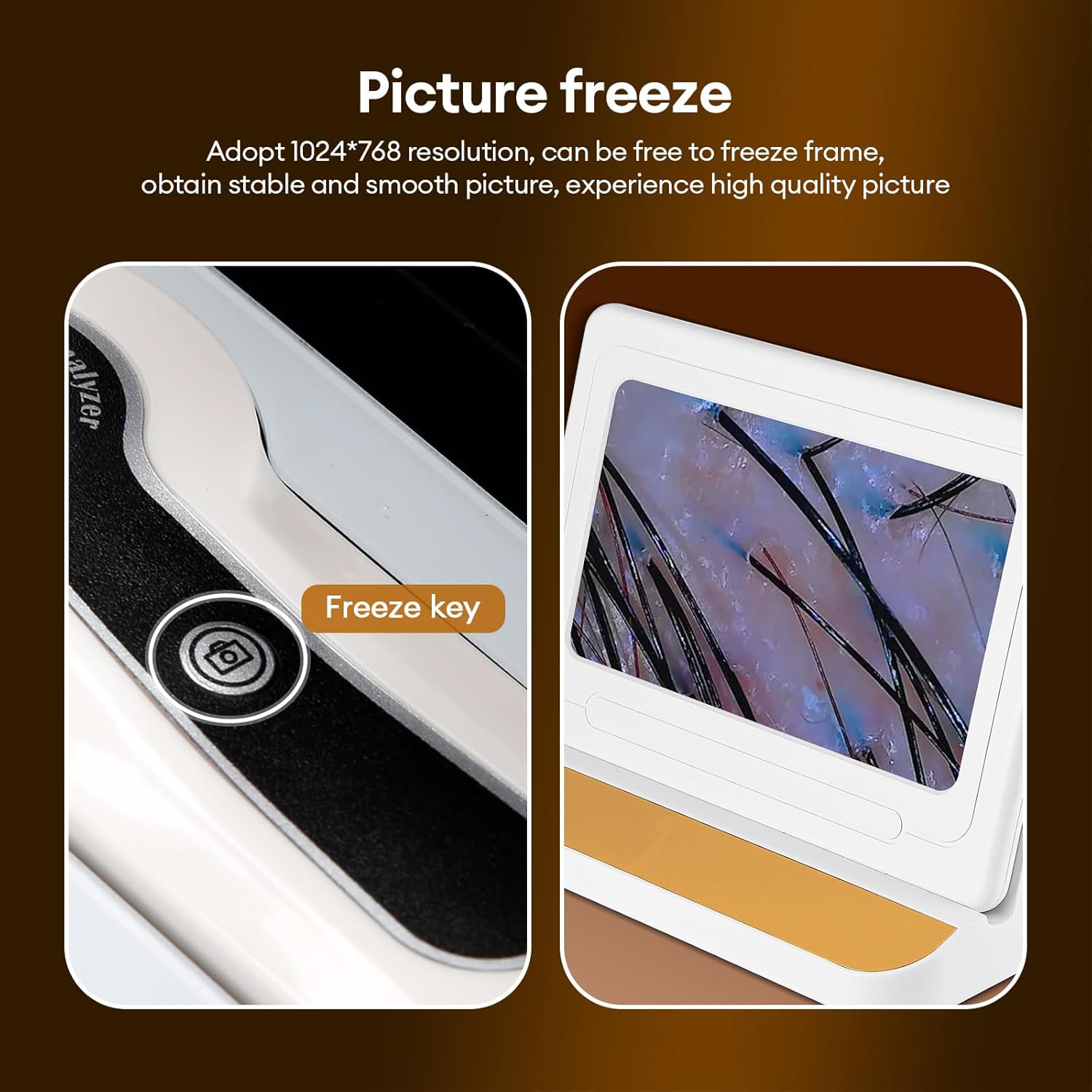 Detalle 2 de Hair Analyzer HD Screen 11 Inch 200X