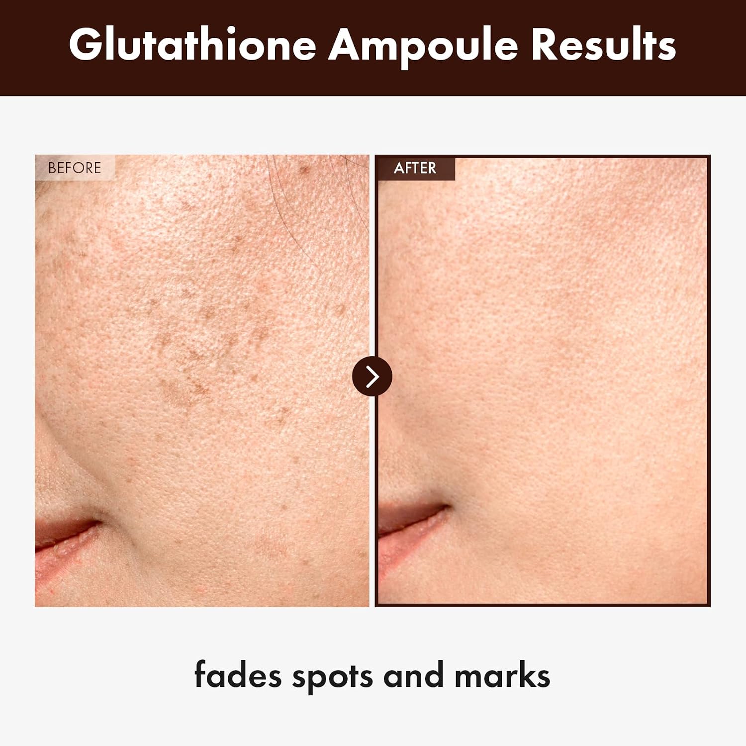 Detalle de TOSOWOONG Glutathione Serum al 99% con 20.000 ppm, niacinamide e acido ialuronico (30 ml)