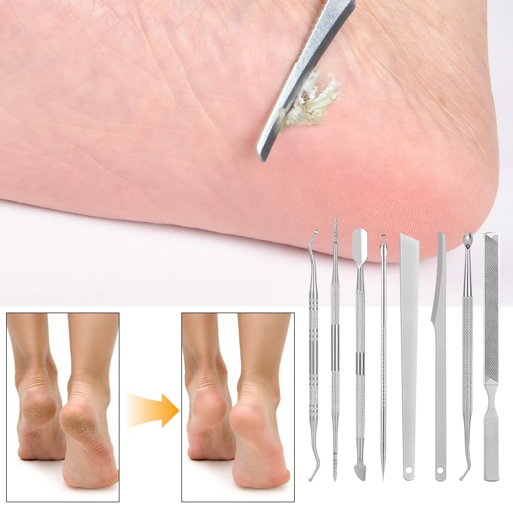 Thumbnail 4 de LOPHE 8-teiliger Set für eingewachsene Zehennägel & Nagelpflege aus Edelstahl