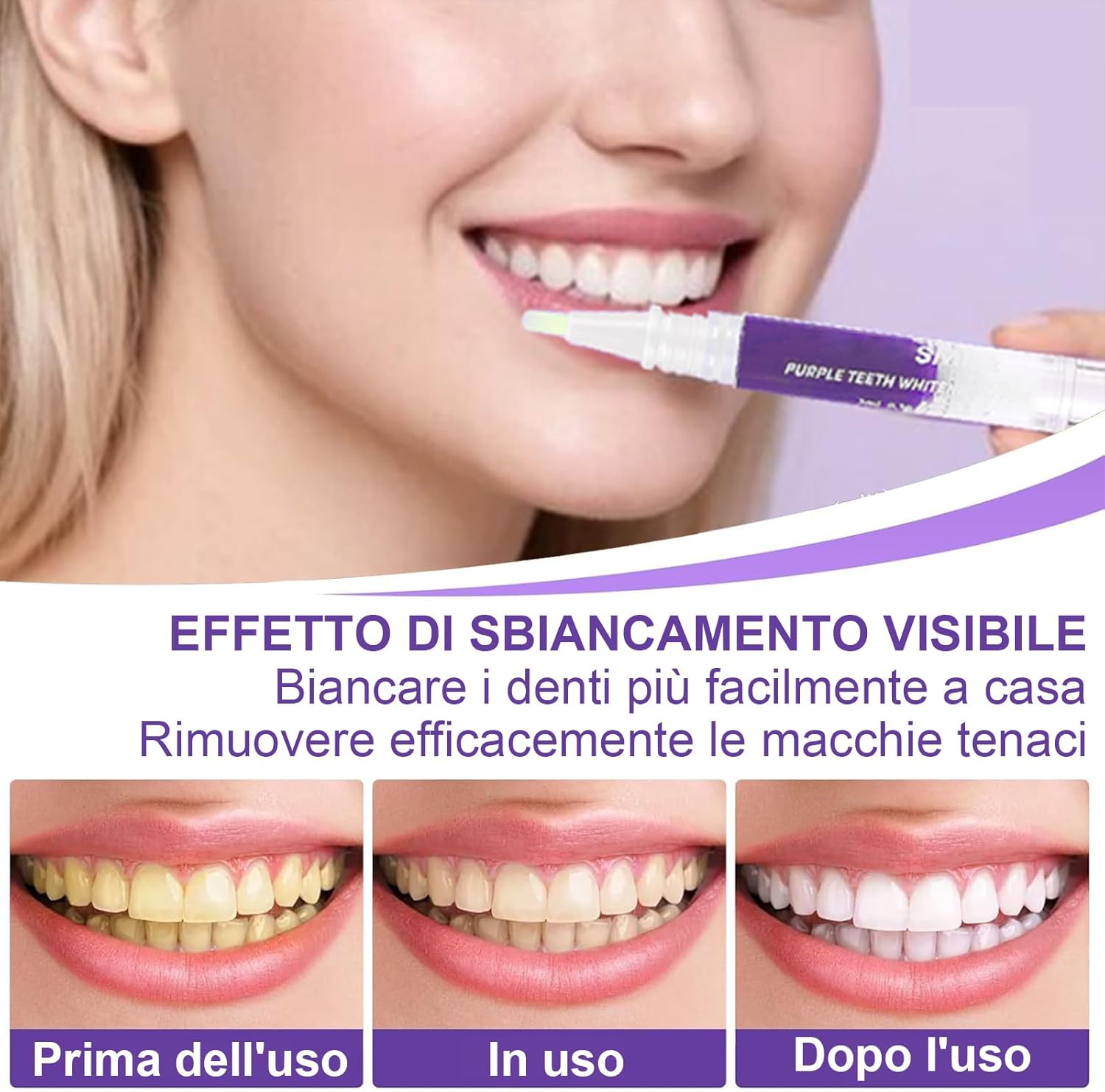 Detalle de Penne Sbiancante Denti – Gel Sbiancamento per Dental, Kit Professionale in Viaggio (Viola, 3 Pezzi)