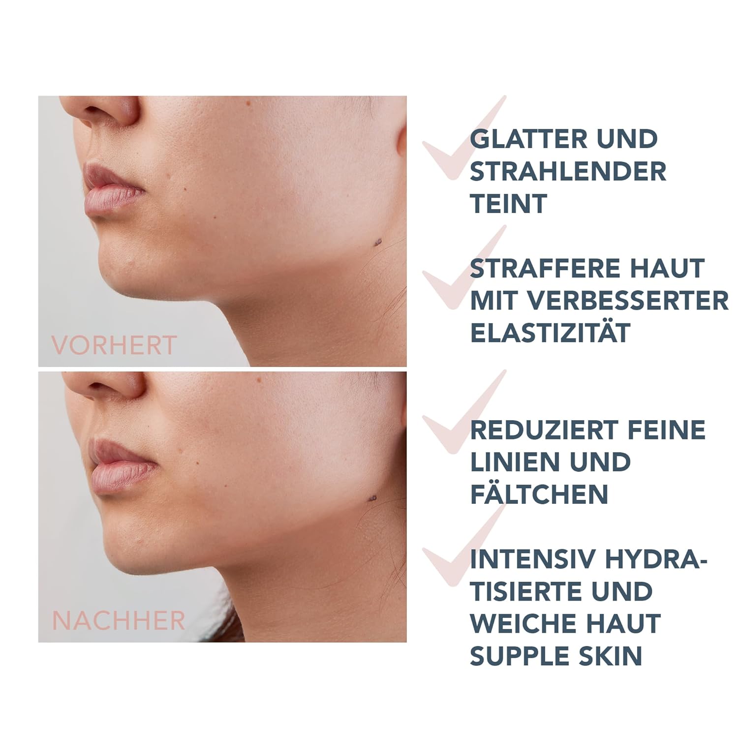 Thumbnail 4 de FOREO SUPERCHARGED Straffendes Serum mit Hyaluronsäure, Squalan und Dreifach-Wirkung