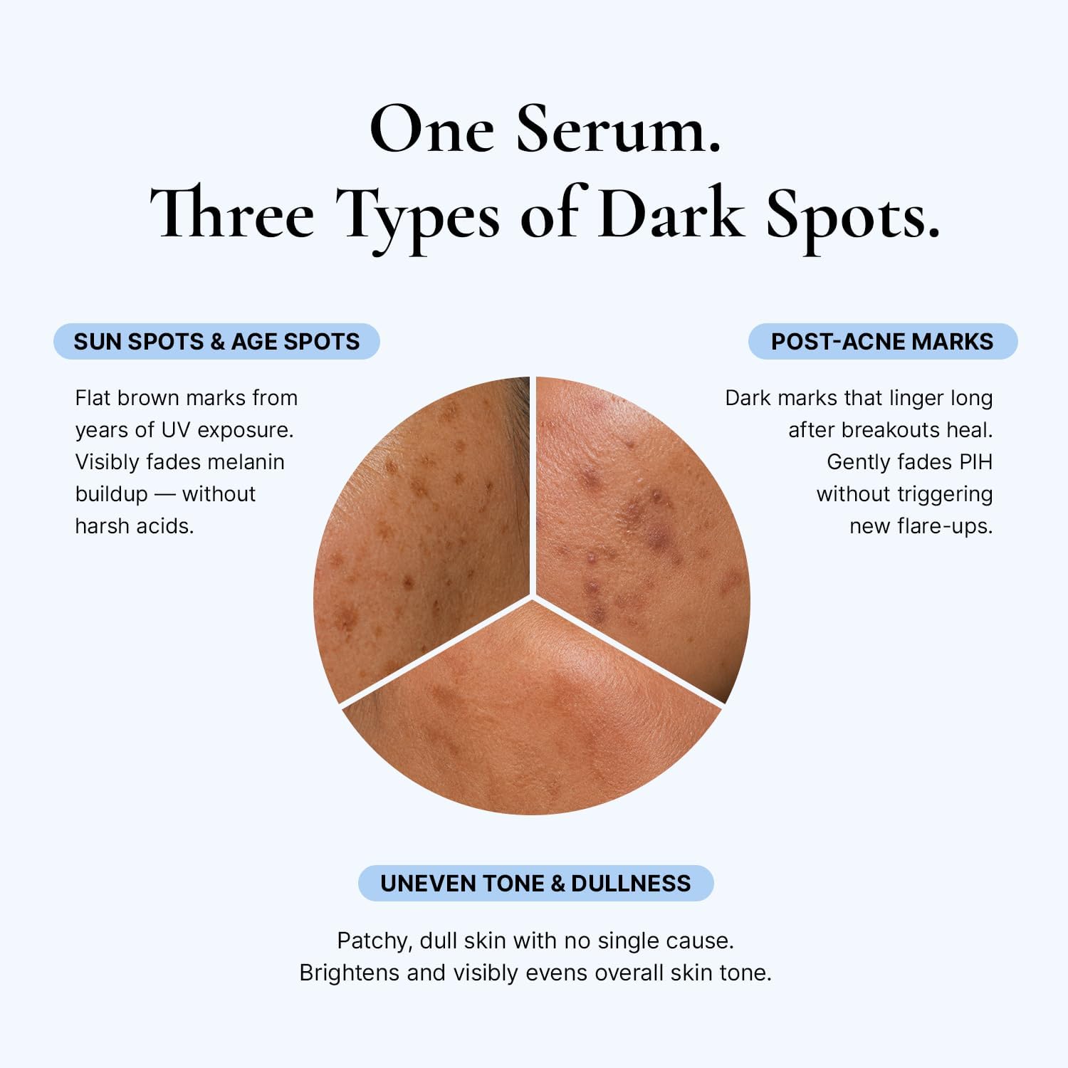 Detalle de EnaSkin Dark Spot Corrector Serum for Face & Body, Niacinamide, 30 mL