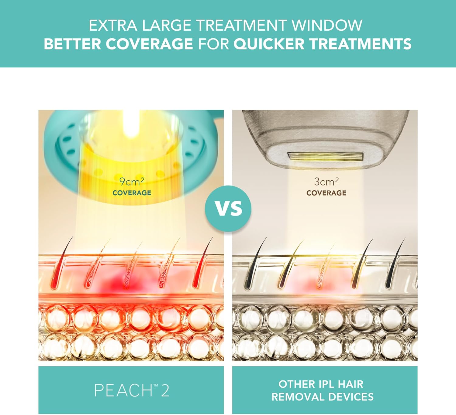 Thumbnail 2 de FOREO PEACH 2 IPL Hair Removal Device (Mint) for smooth skin at home
