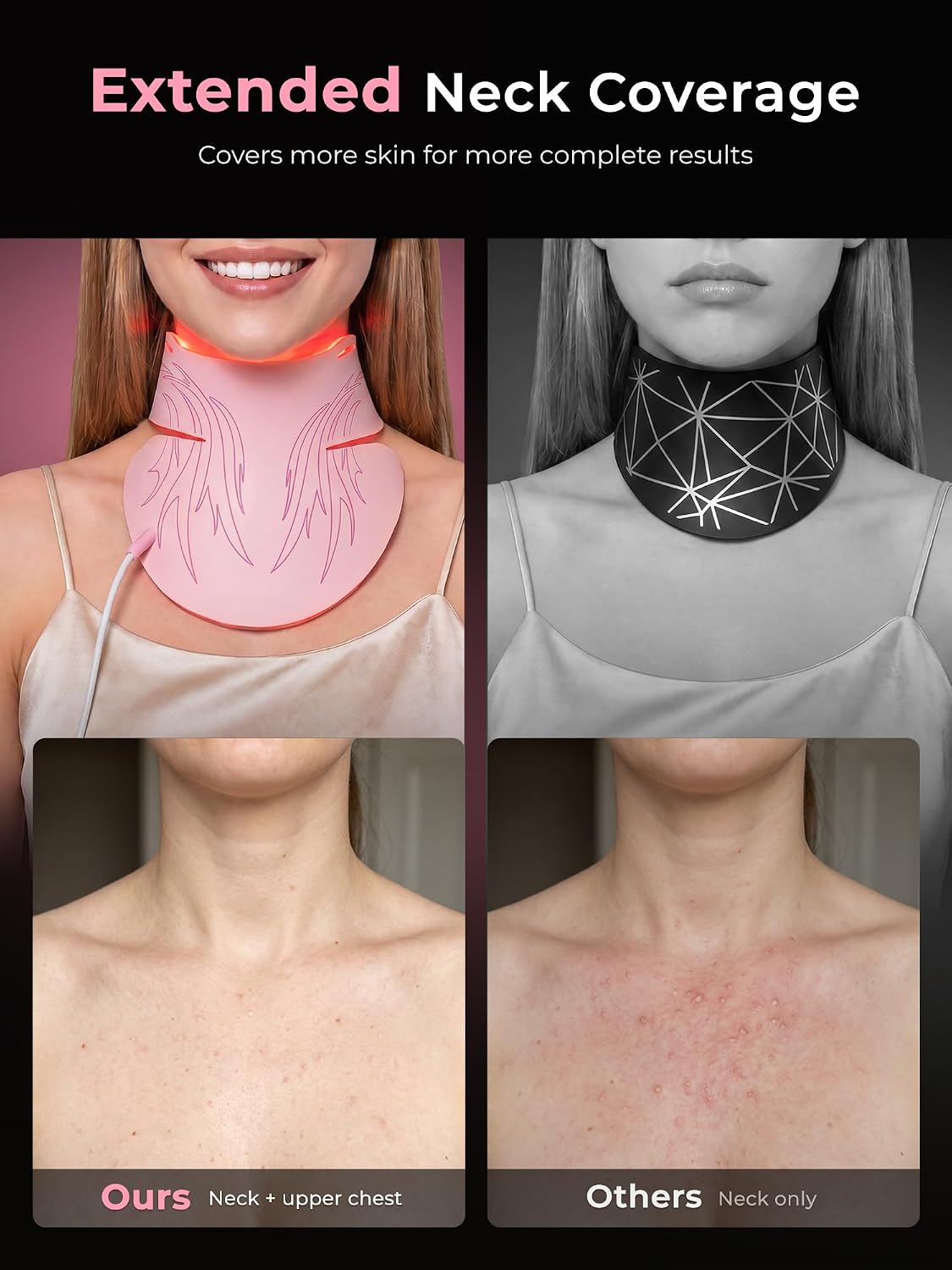 Detalle de Qynera LED Face Mask 850nm
