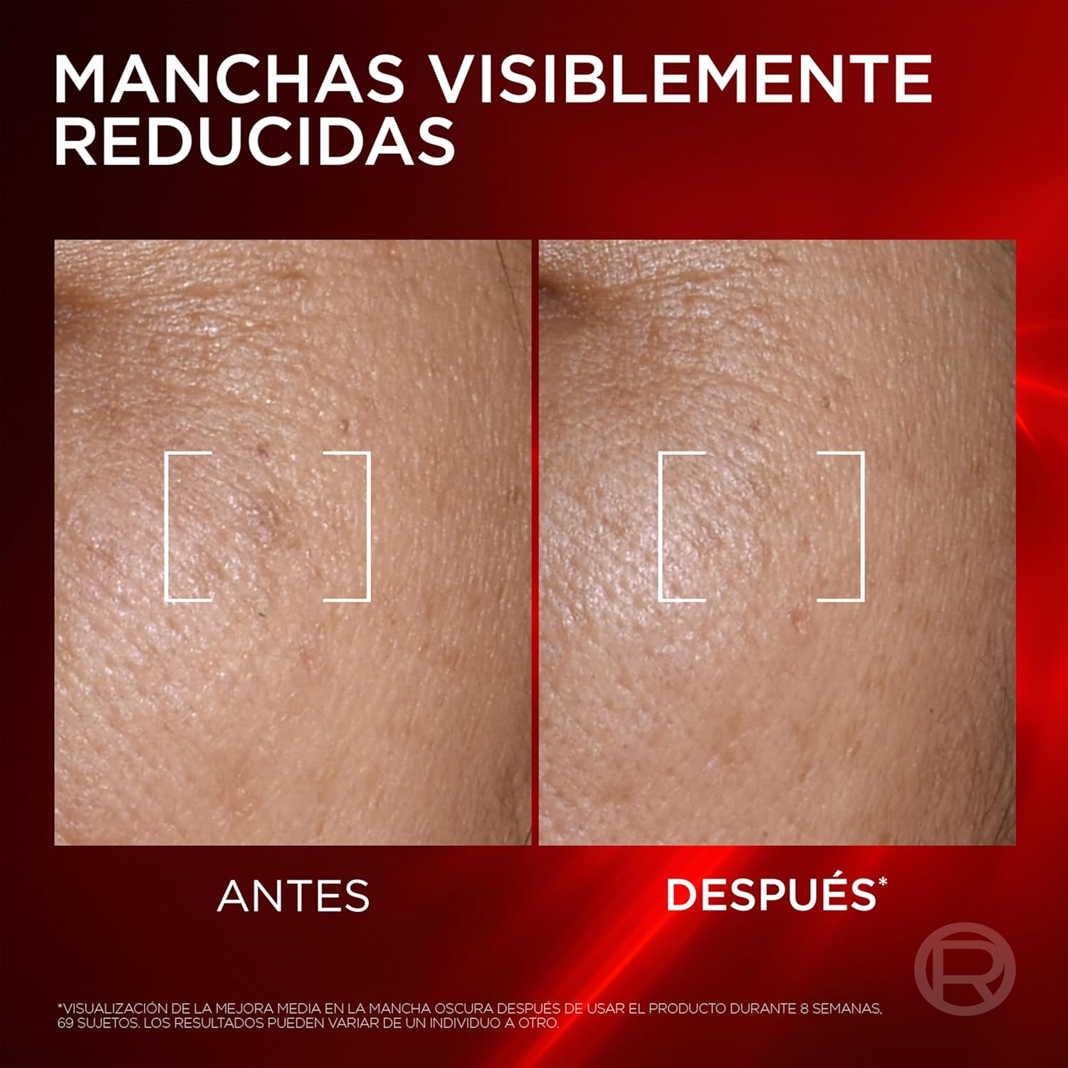 Detalle 2 de L’Oréal Paris Revitalift Laser Triple Serum con Melasyl, Vitamina C y Niacinamida (50 ml)