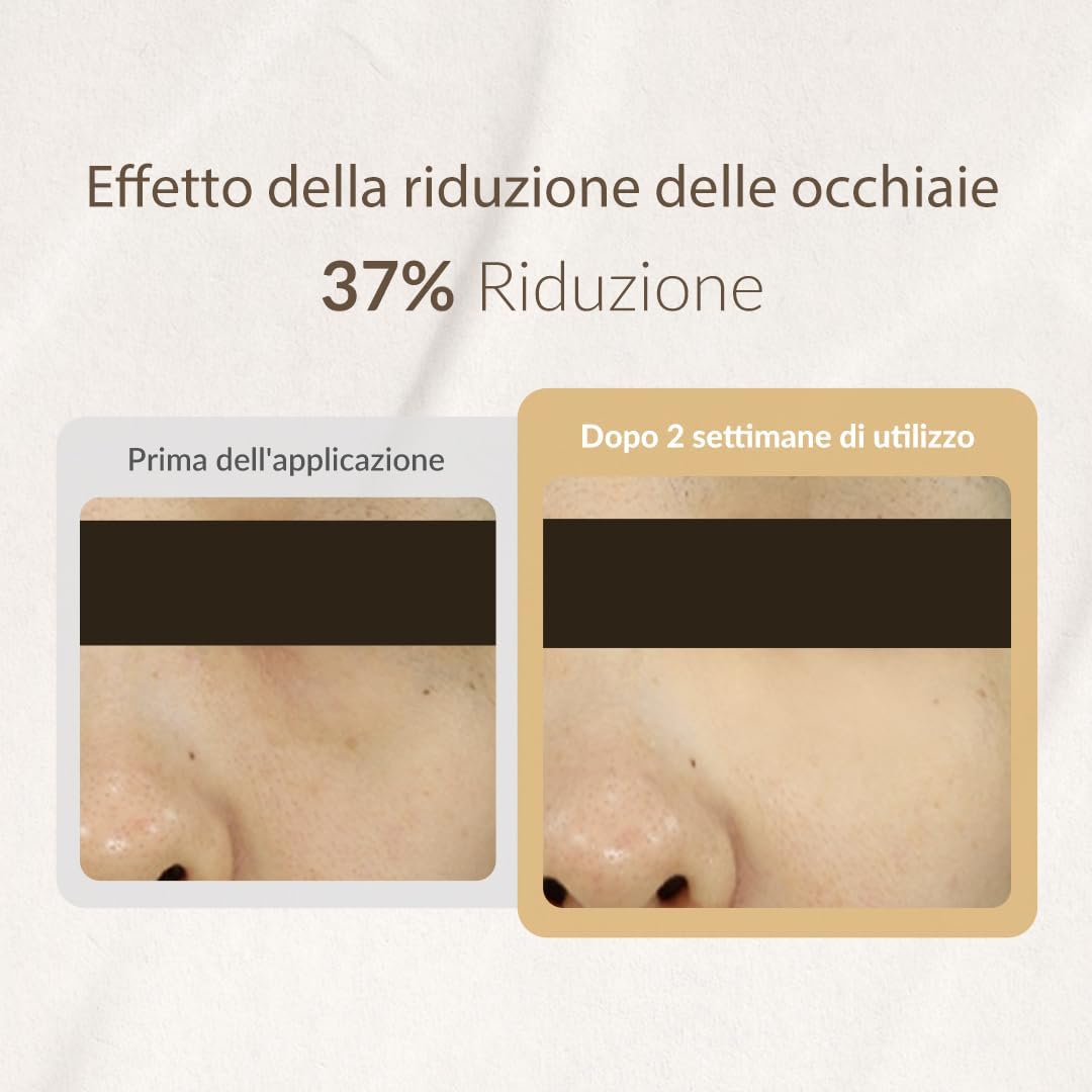 Thumbnail 5 de MIZON SNAIL REPAIR EYE CREAM 25ml
