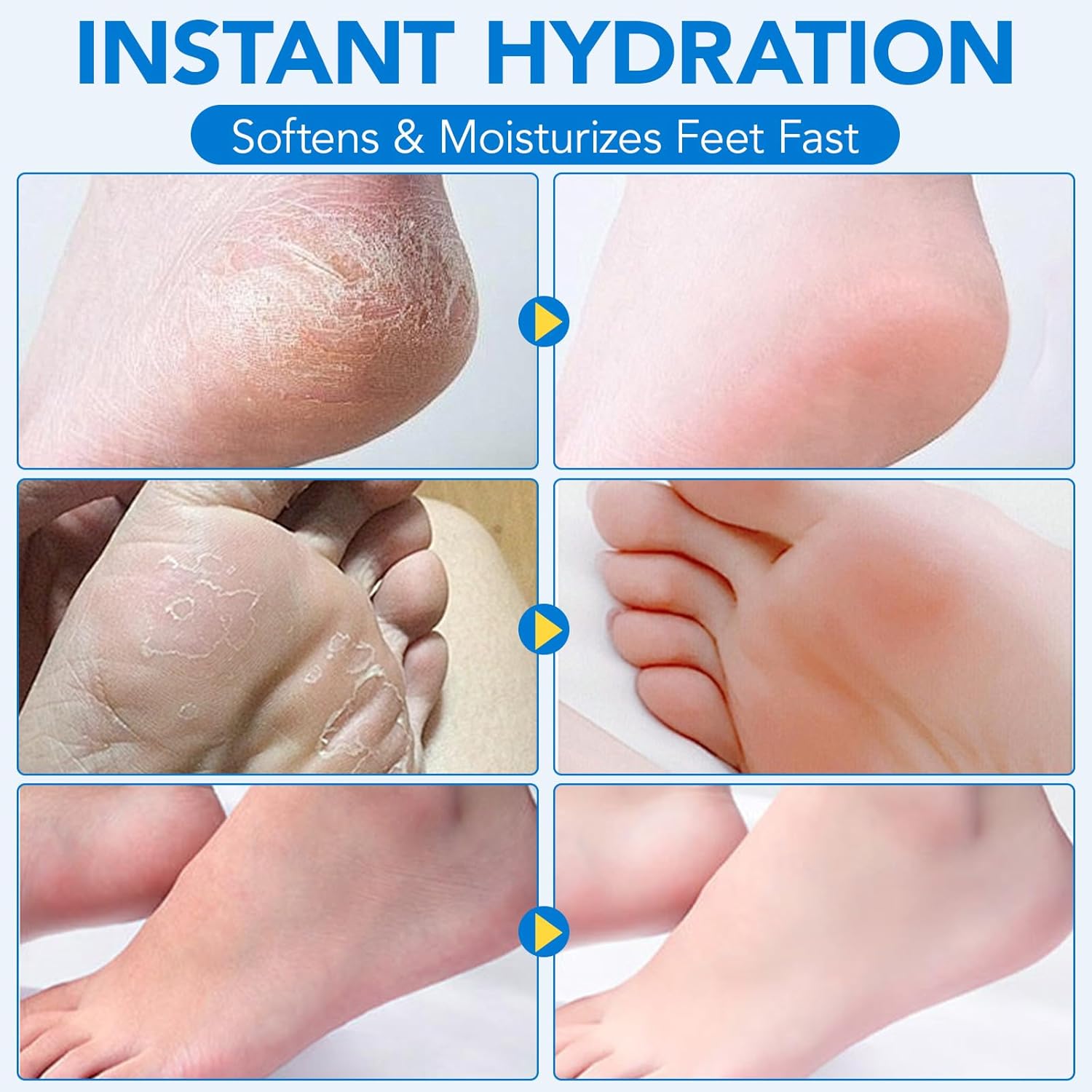 Thumbnail 6 de Uruses Urea Cream 60% Foot Care Stick