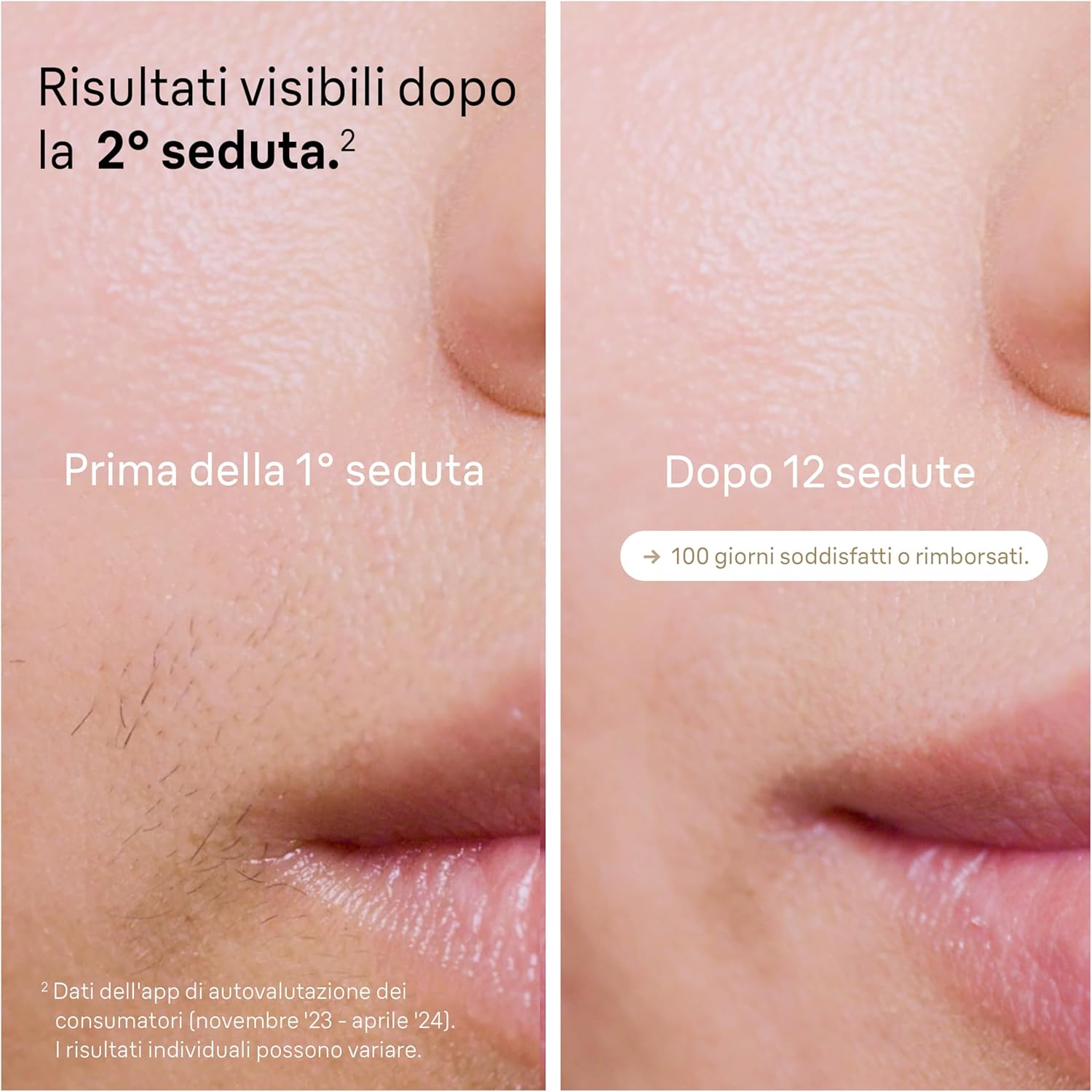 Thumbnail 2 de Braun Silk-expert Pro 5 Epilatore Luce Pulsata