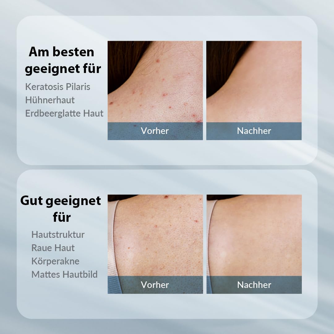 Thumbnail 6 de Village11Factory VALENTINSTAG AHA 12% Lotion