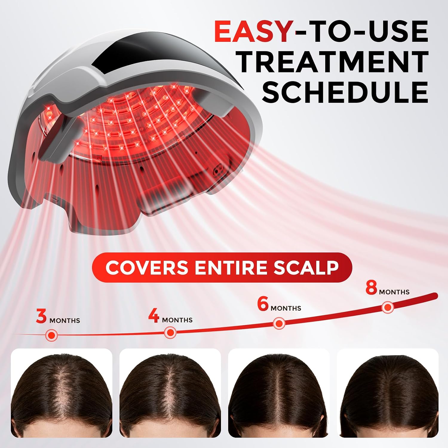 Thumbnail 4 de OVEKPA Red Light Therapy Laser Cap for Hair Growth (FDA-cleared) — at-home LLLT for men & women