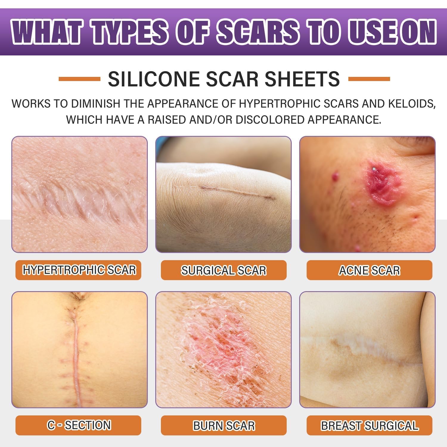 Thumbnail 1 de Silicone Scar Sheets 1.6" x 157" Roll