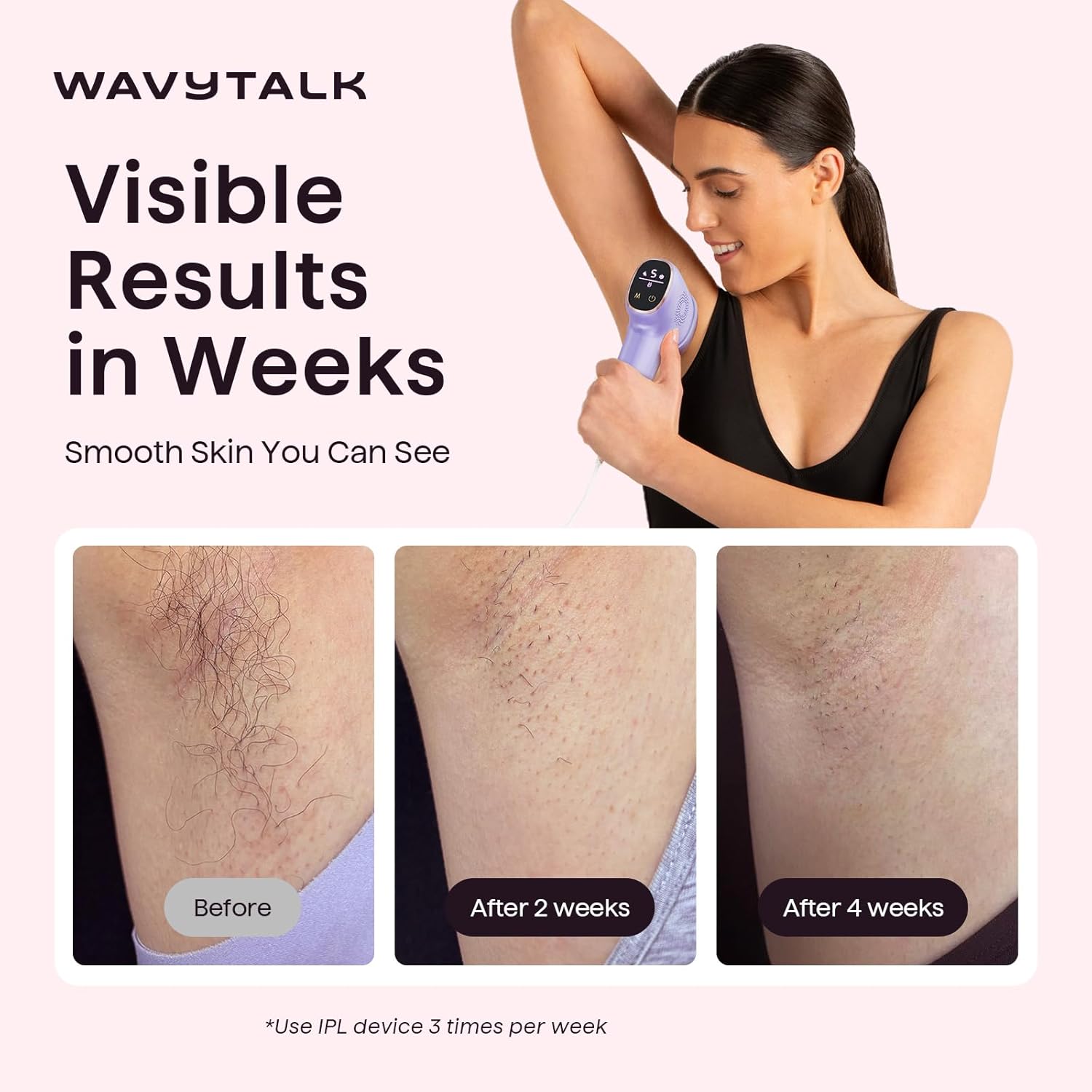 Detalle de Wavytalk IPL Hair Removal Device “Bare It” (Face, Body & Bikini) with Ice Cooling, Corded