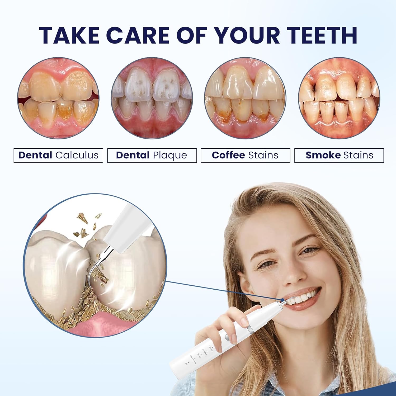 Detalle 2 de HOKIN Plaque Remover Dental Care Kit: Stainless Steel Teeth Cleaning Tools for All the Family