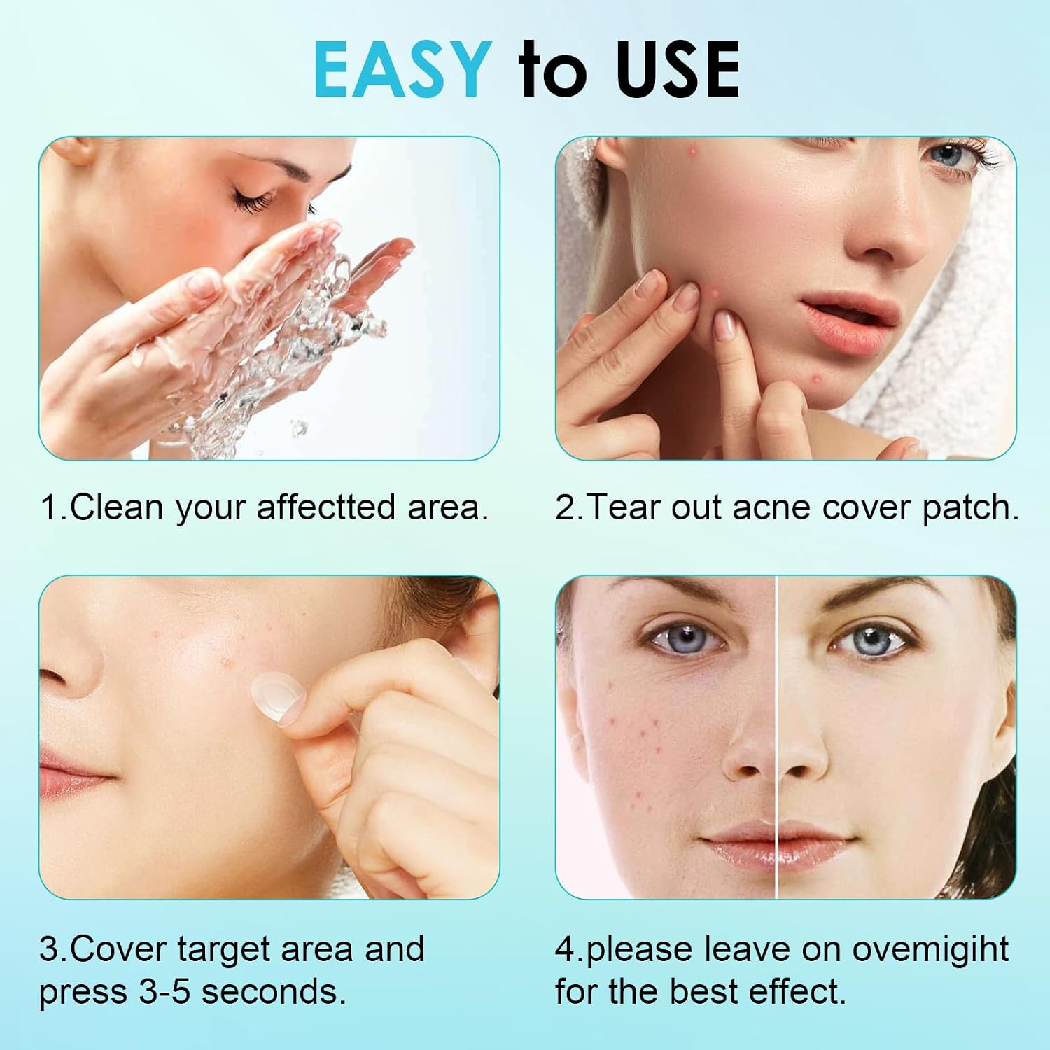 Detalle 2 de PimpleGuard 330-Piece Hydrocolloid Pimple Patches, Ultra-Thin Day & Night