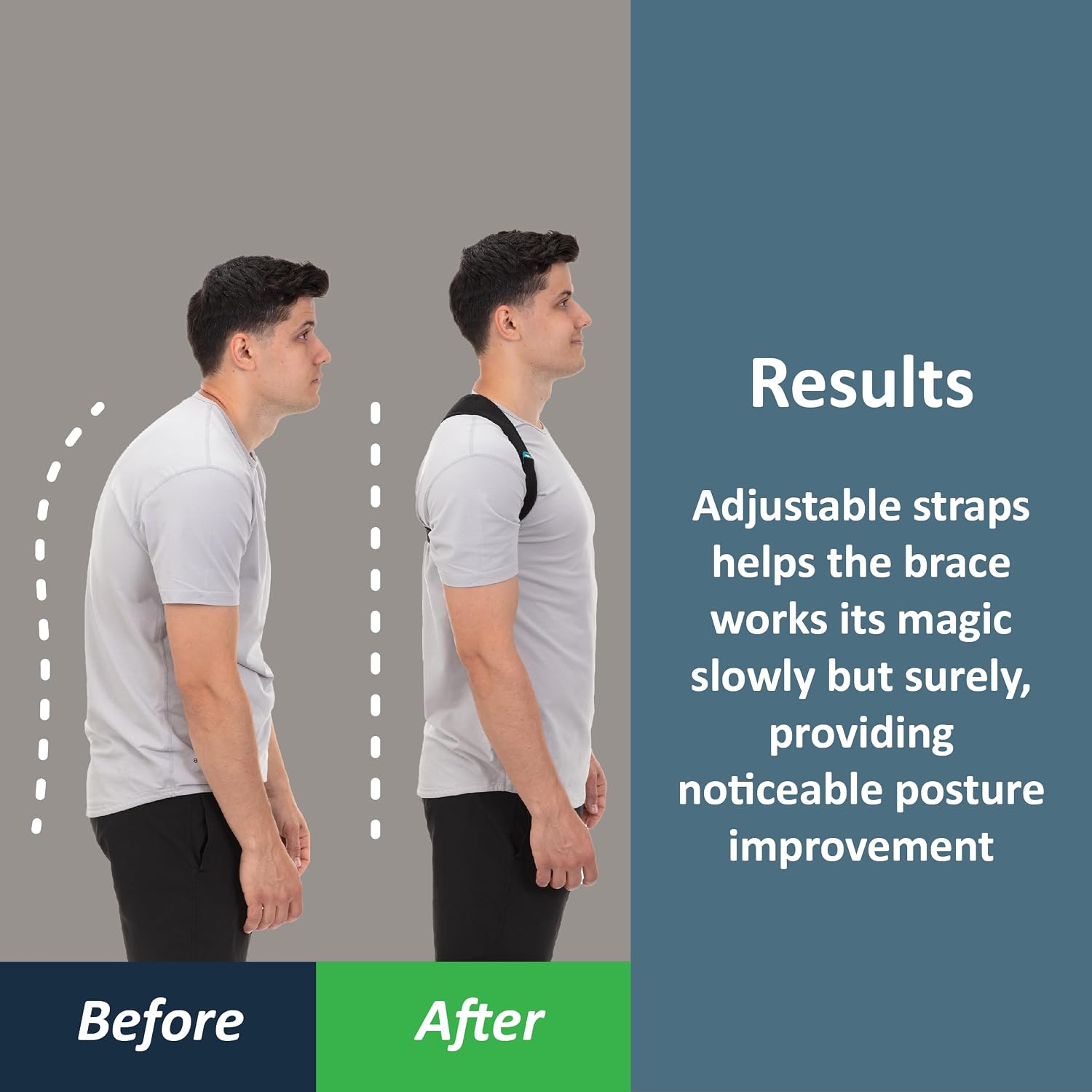 Detalle de ComfyBrace Posture Corrector: Fully Adjustable Back Brace for Day-to-Day Pain Relief