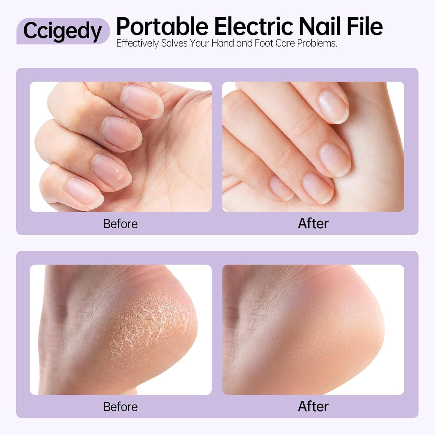 Thumbnail 6 de Electric Nail Drill Kit