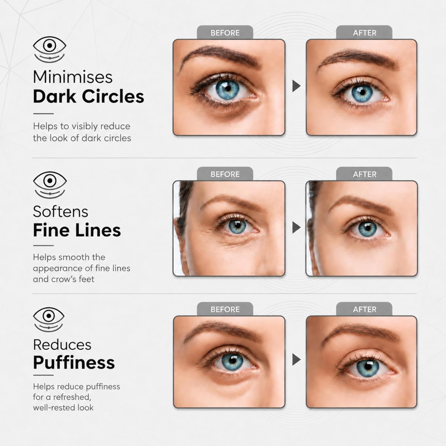 Thumbnail 2 de Revitale Pure Vegan Under Eye Patches – Masques pour les yeux riches en Aloe Vera et acide hyaluronique (30 paires)