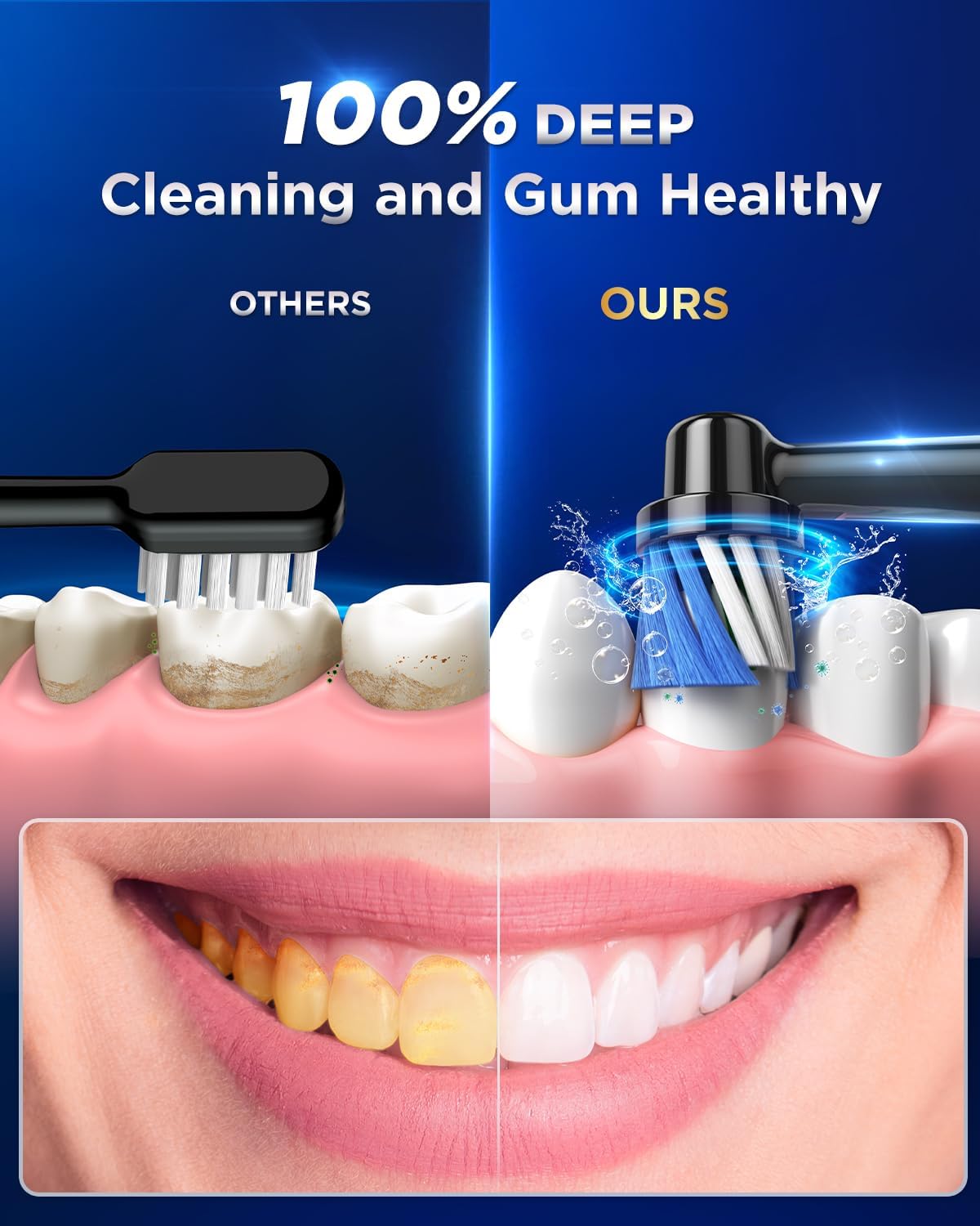 Detalle de Rotating Electric Toothbrush with 8 Brush Heads (2 Types) for Adults | 3 Intensities, 5 Modes, and Wall Charging