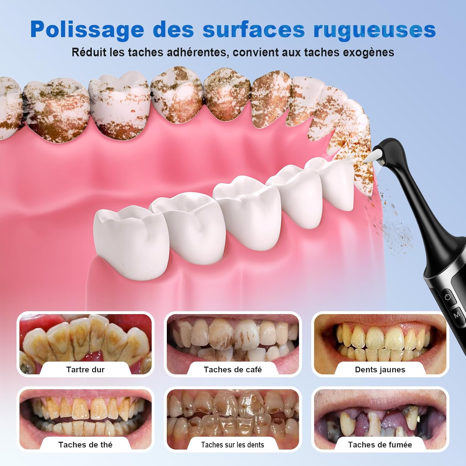 Thumbnail 1 de Kit Blanchiment Dentaire polisseur électrique 5 têtes 🪥