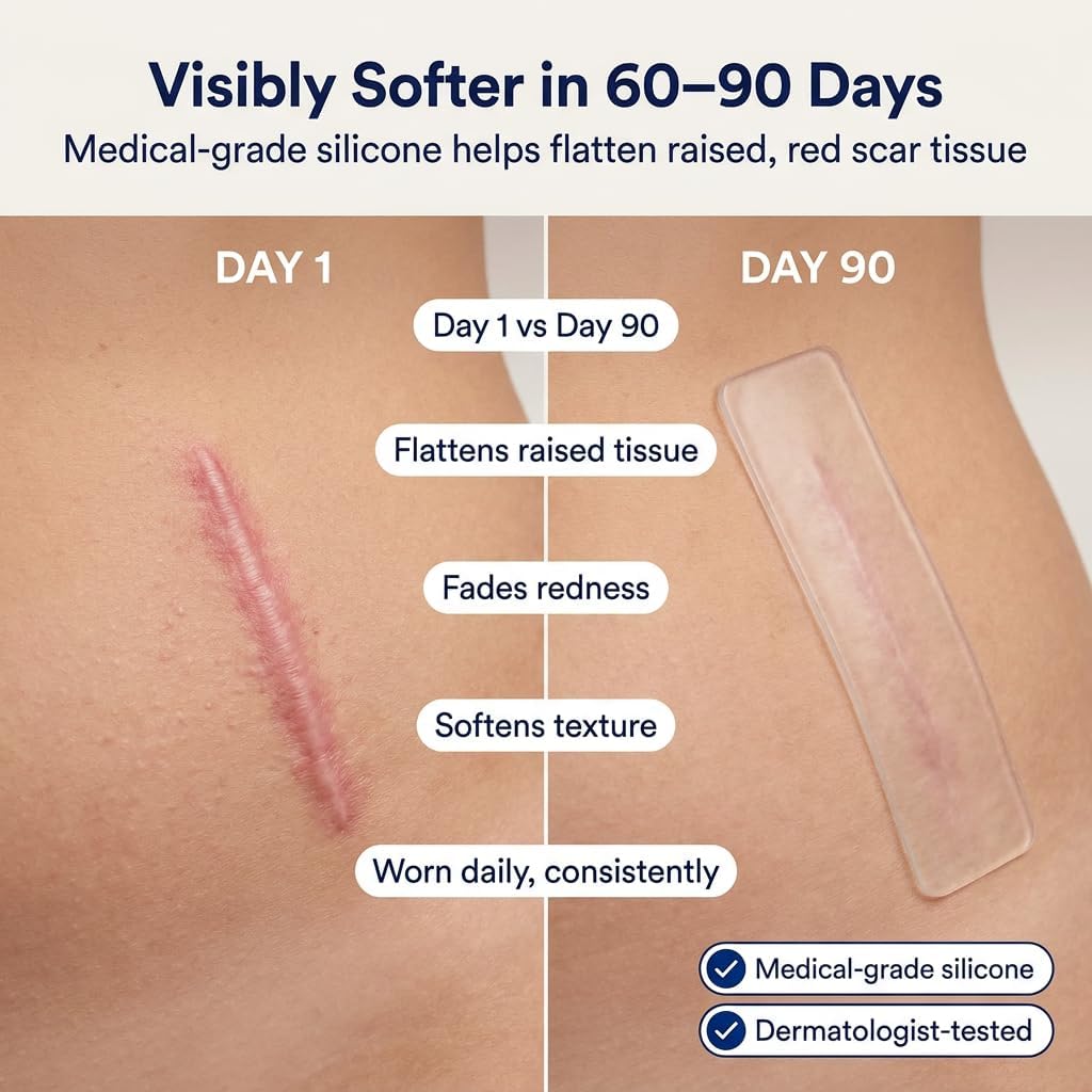 Thumbnail 1 de ScarFix+ Silicone Scar Tape: 18 pre-cut transparent plasters in 3 sizes