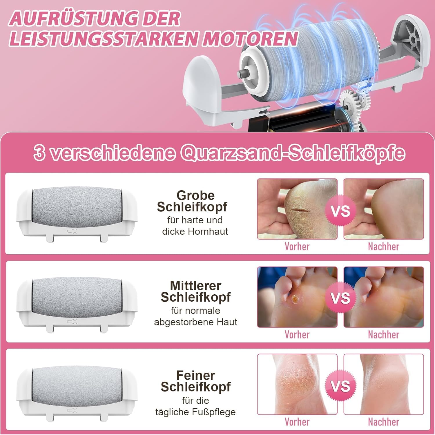 Detalle de Hornhautentferner Elektrisch von AOMEES – einstellbare Geschwindigkeiten, IPX7, 3 Rollenköpfe