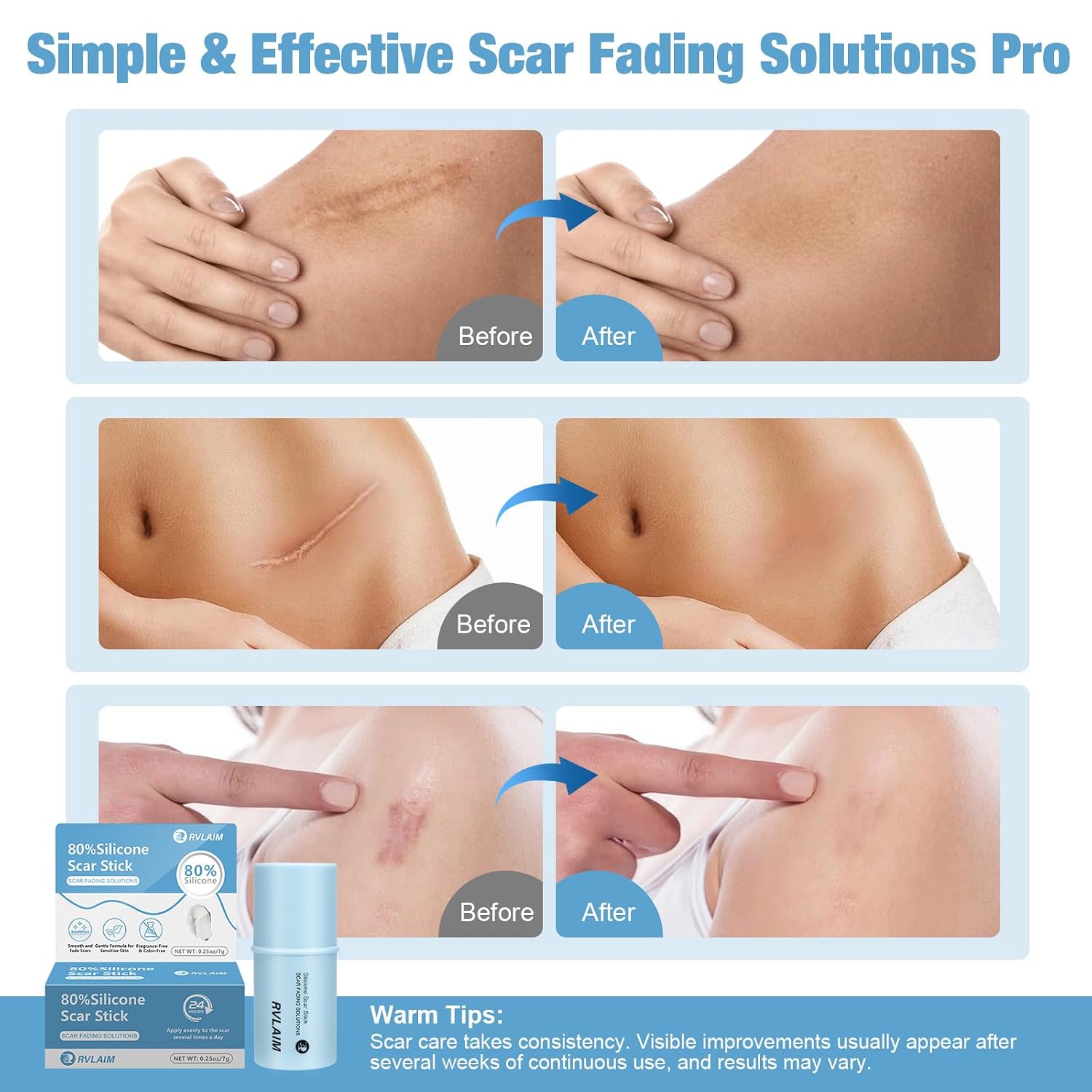Detalle de Rvlaim Silicone Scar Stick 7g