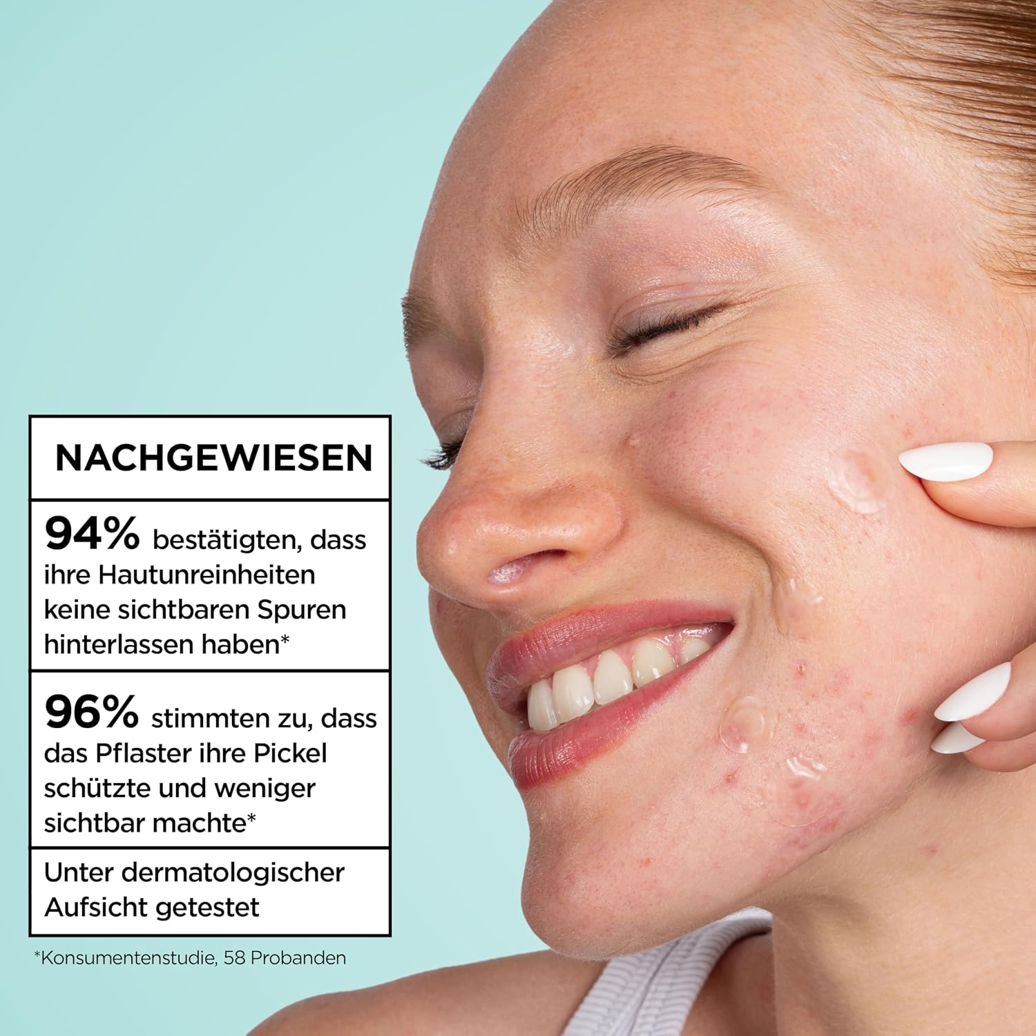 Thumbnail 4 de Garnier Hautklar Pimple Patches Ultra Hydrokolloid gegen Pickel – 22 Stück