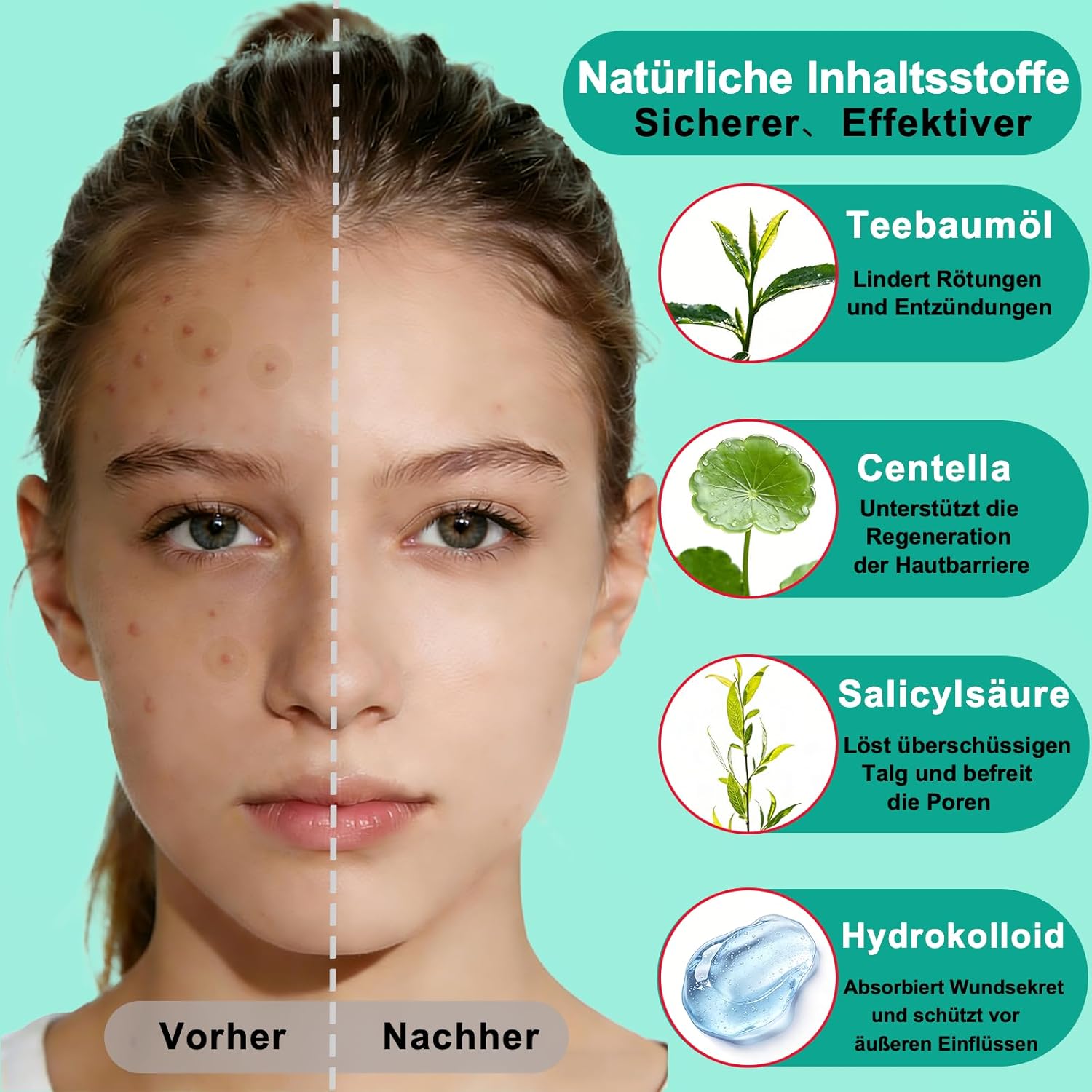 Detalle de Zosilong 720 unsichtbare Pickel-Patches – hautfreundliche Pimple Patches für Tag & Nacht