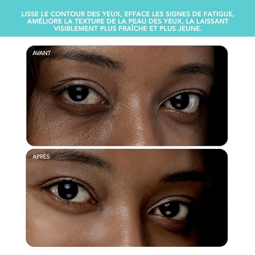 Detalle de FOREO IRIS 2 – Appareil de massage rajeunissant yeux