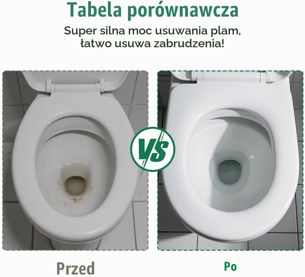 Thumbnail 5 de ANOMM zestaw pumeksowy do toalety, 10 wymiennych kamieni i 2 uchwyty