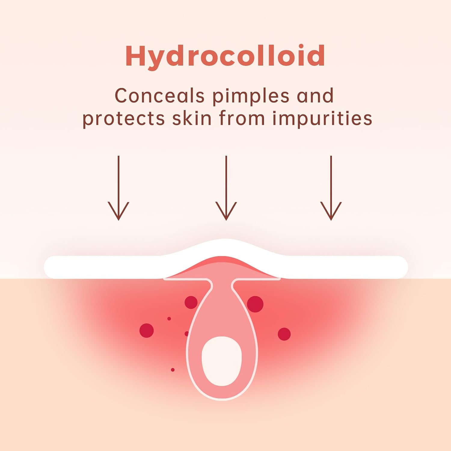 Thumbnail 4 de Hydrocolloid acne patches, 216 count