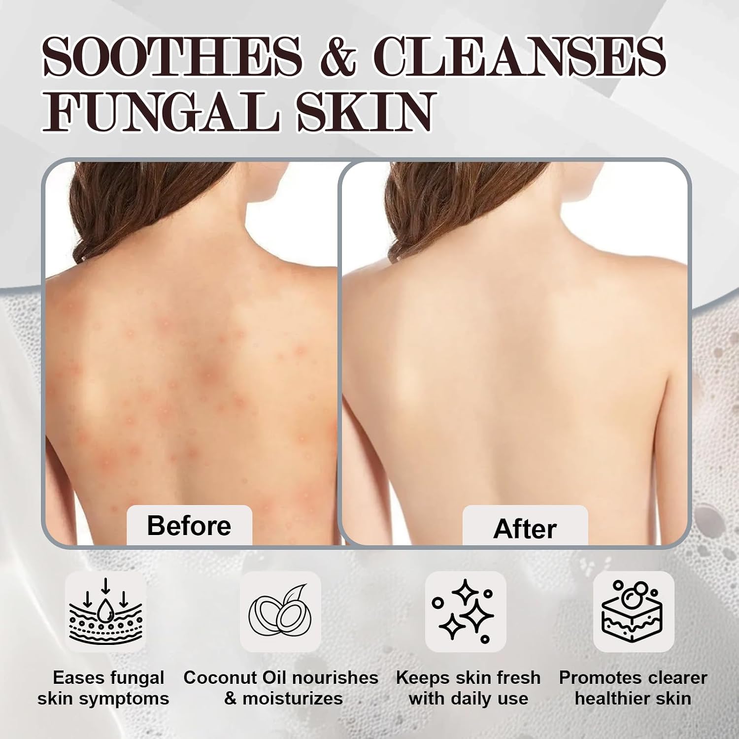 Thumbnail 4 de NXPPYY Antifungal Soap, 3-Bar Pack
