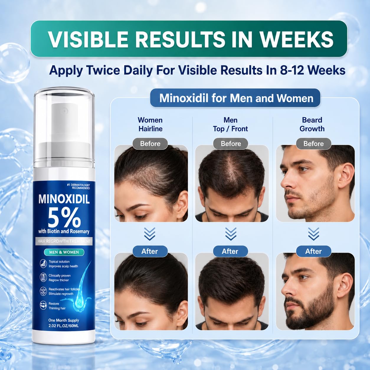 Detalle 2 de Rylx 5% Minoxidil Hair Growth Serum, 60 mL Spray with Biotin and Rosemary