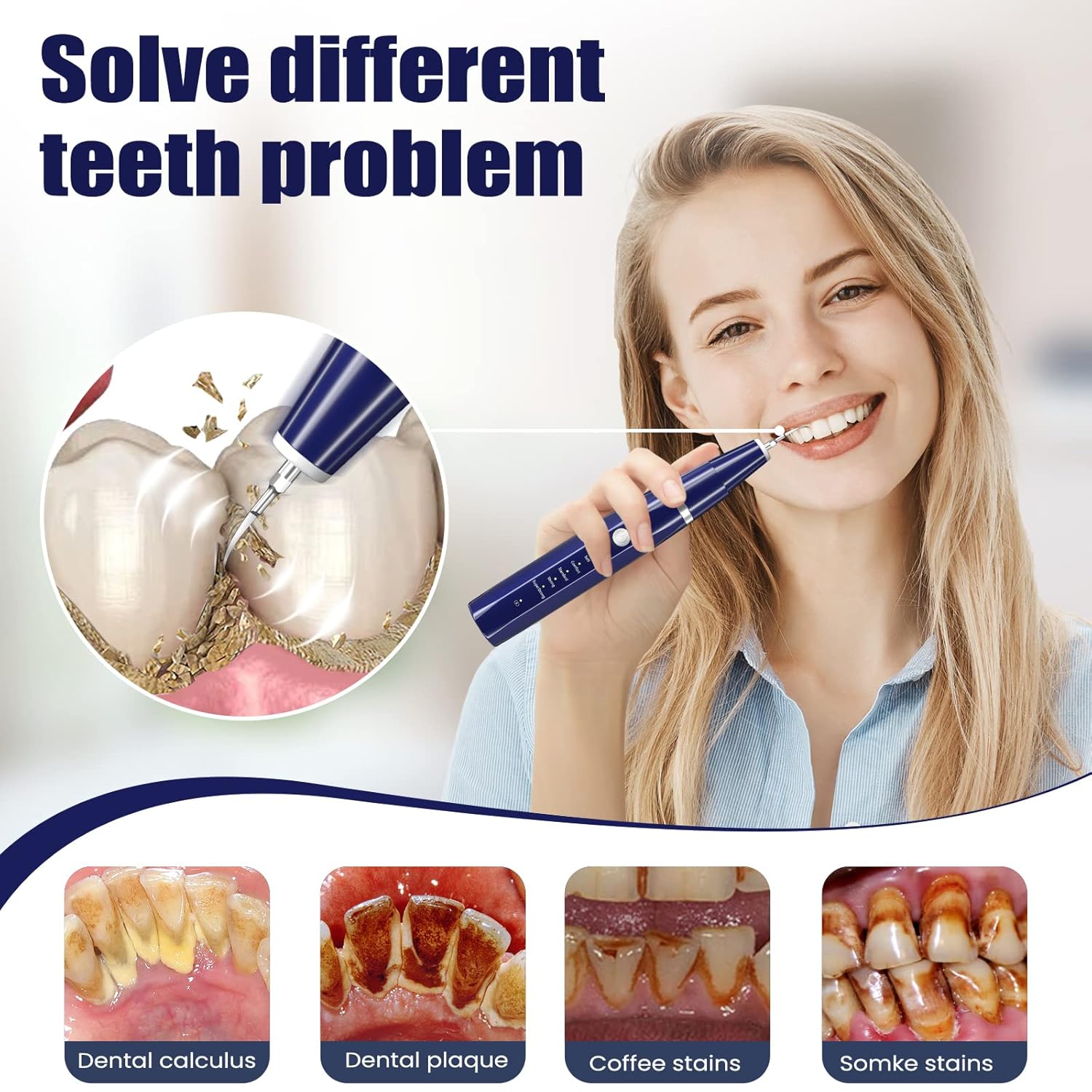 Detalle de Plaque Remover for Teeth - Tartar Remover for Teeth, Dental Calculus Remover Teeth Cleaning Kit