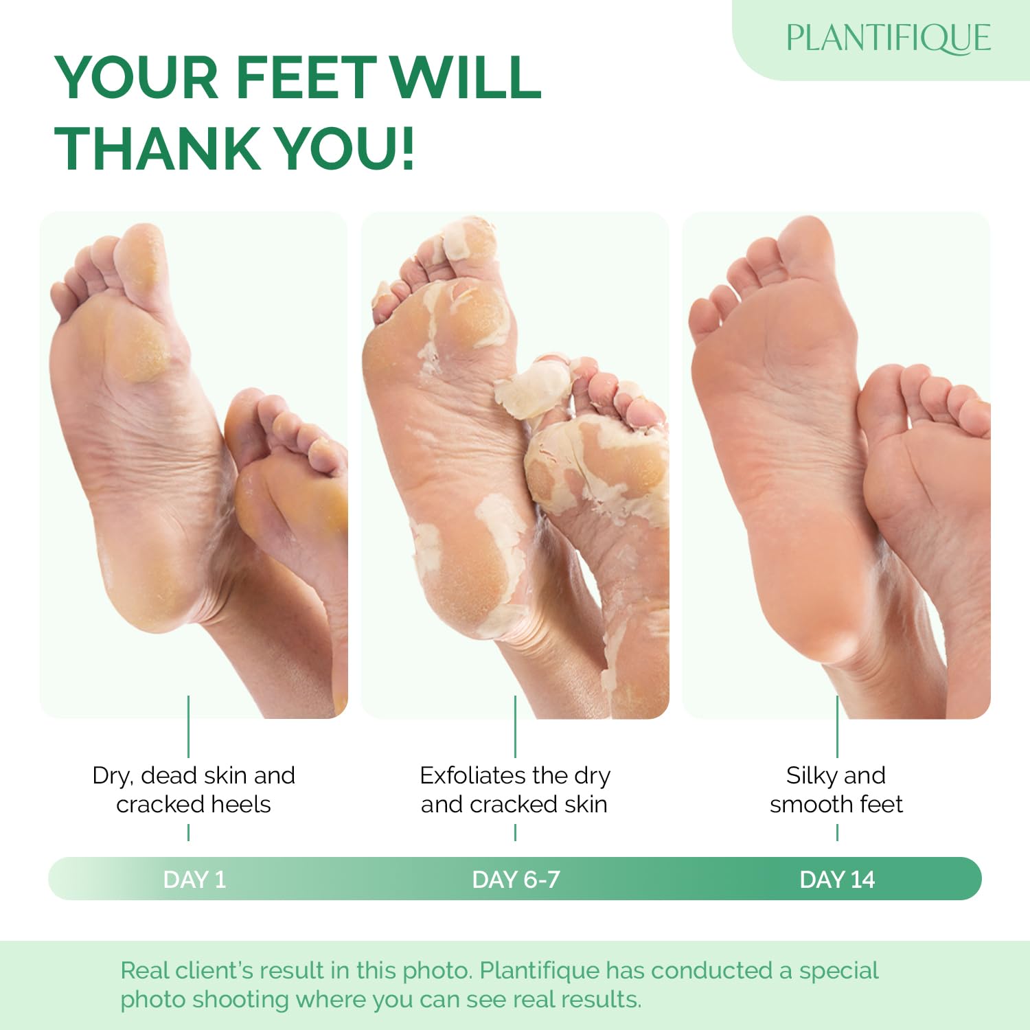 Detalle de PLANTIFIQUE Foot Peeling Mask for Baby-Soft Heels 🦶