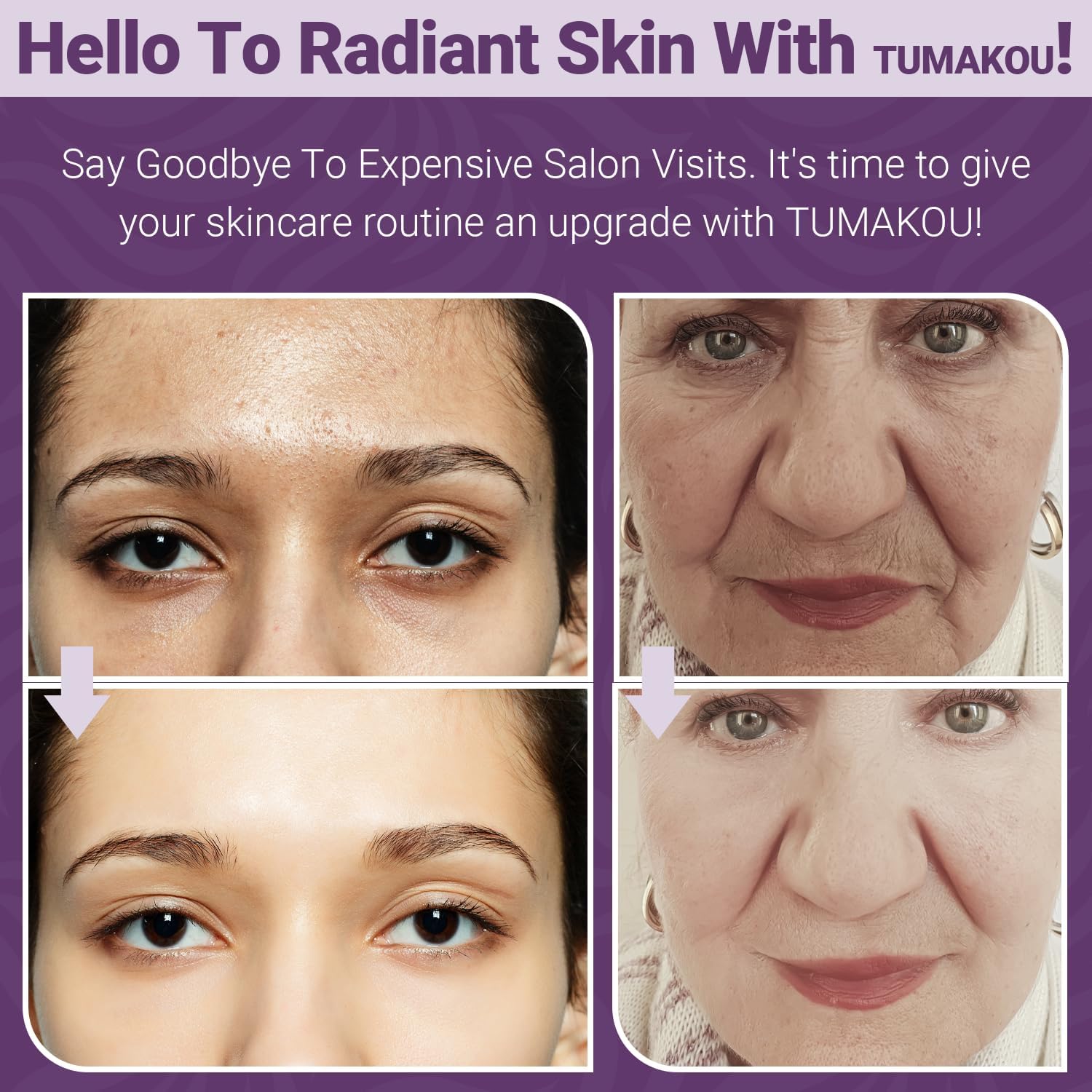 Thumbnail 4 de Appareil radiofréquence visage TUMAKOU 4 en 1 EMS micro-courant et luminothérapie (bleu rouge) pour le lifting à domicile