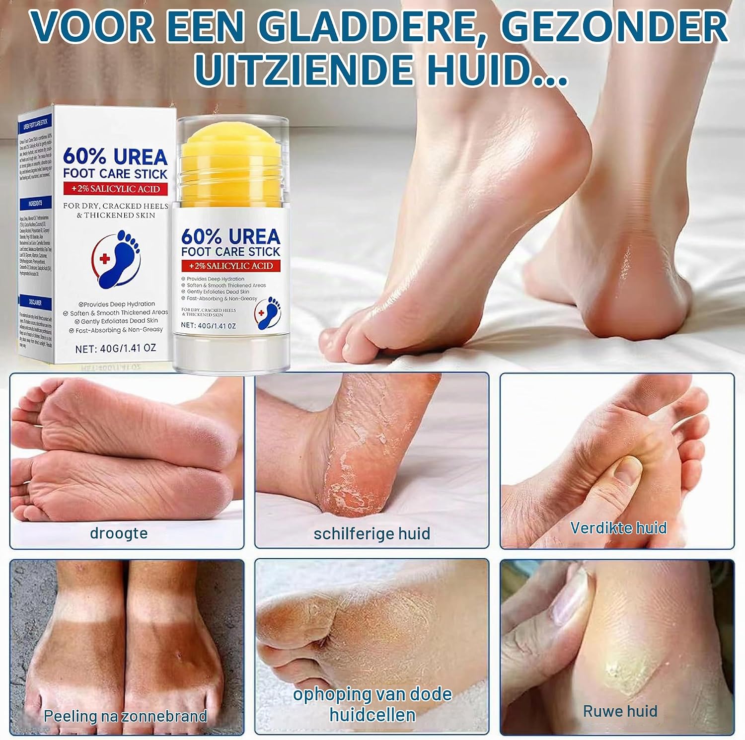 Thumbnail 1 de Chenduoran ureumvoetcrème 60% met hyaluronzuur, aloë vera en jojobaolie, 40 g